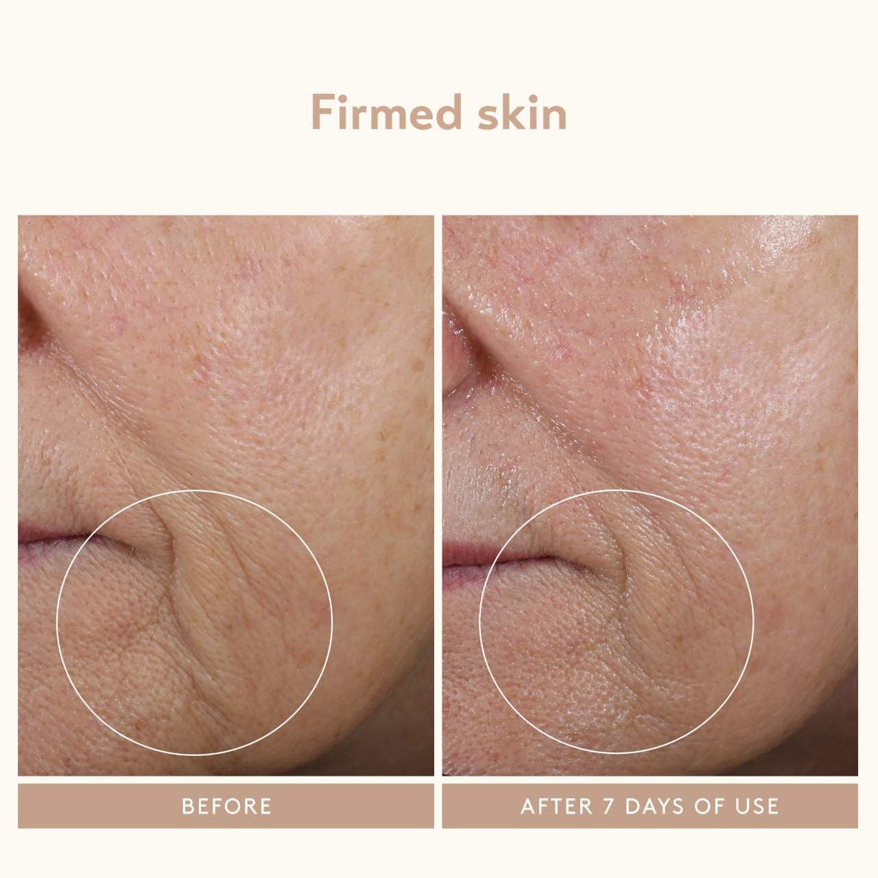 Скульптурирующий массажёр для лица Shani Darden Skin Care — фото 4