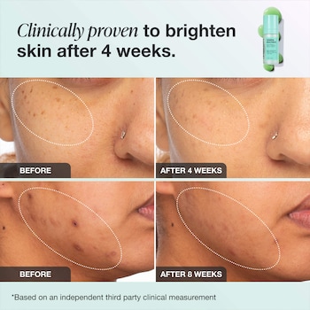 Vitamin C Skin before And After: Stunning Transformations Revealed