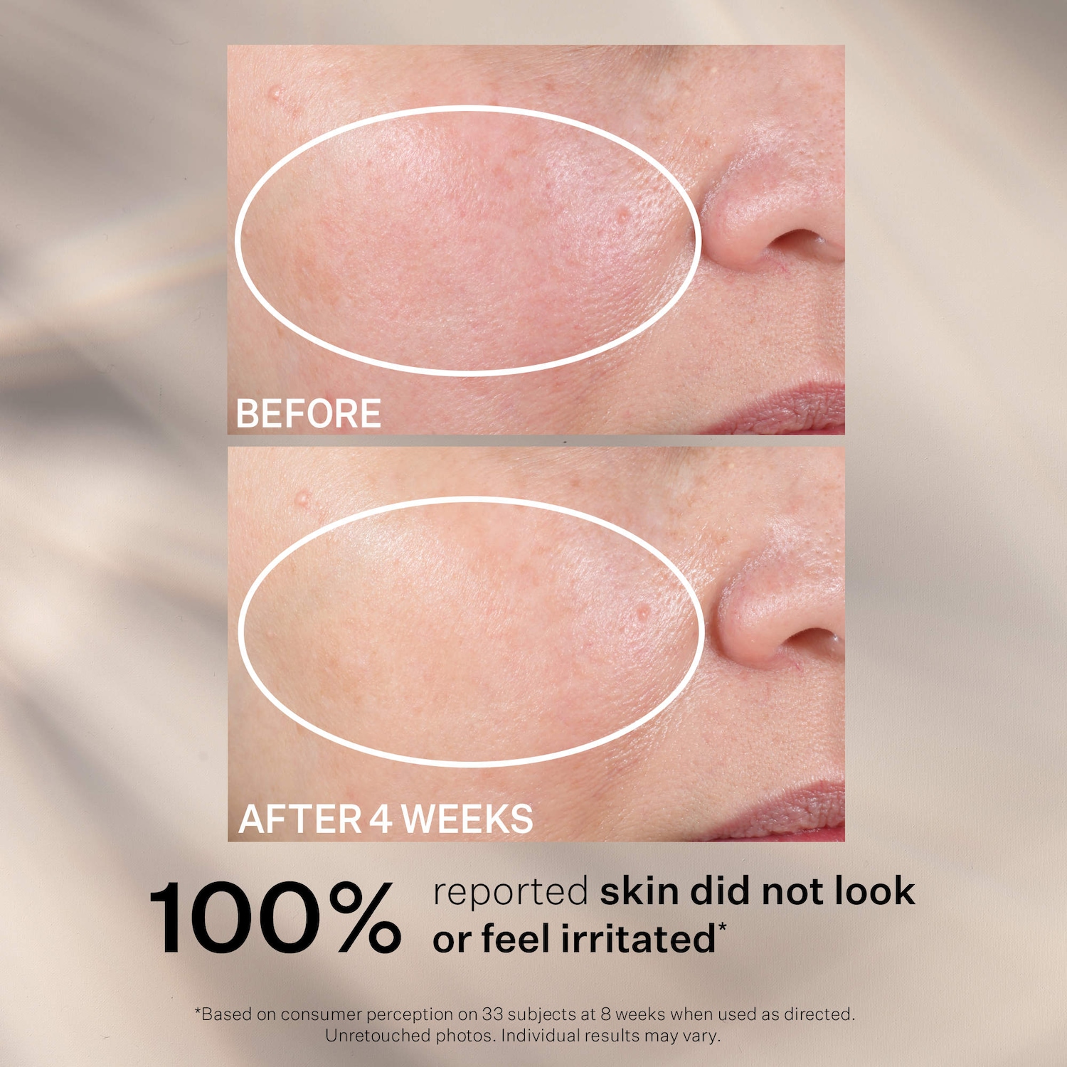 StriVectin ARナイトモイスチャライザー 30ml Advanced Retinol Nightly Renewal Face Moisturizer with Retinol