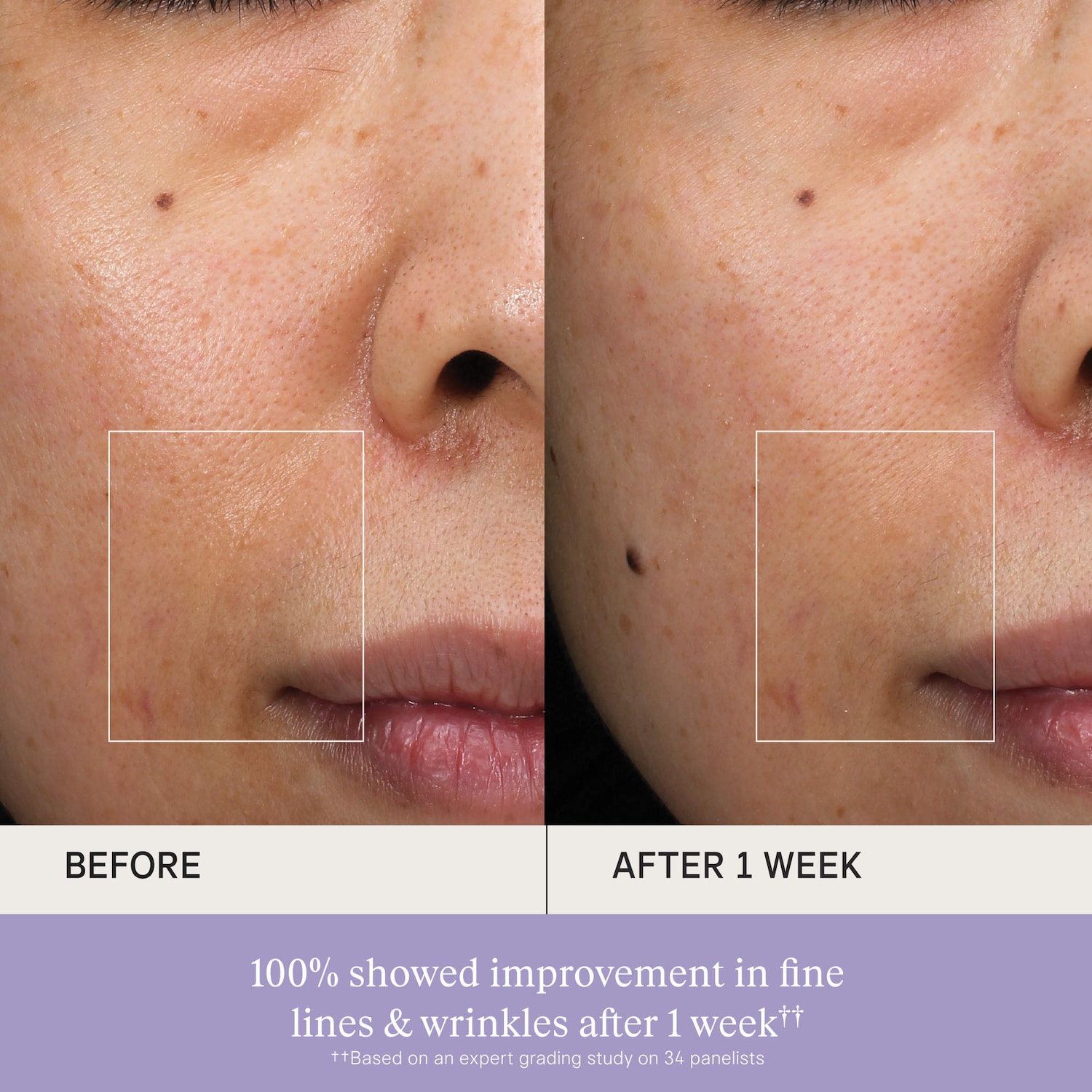 The Essence Skincare Boosting Treatment
