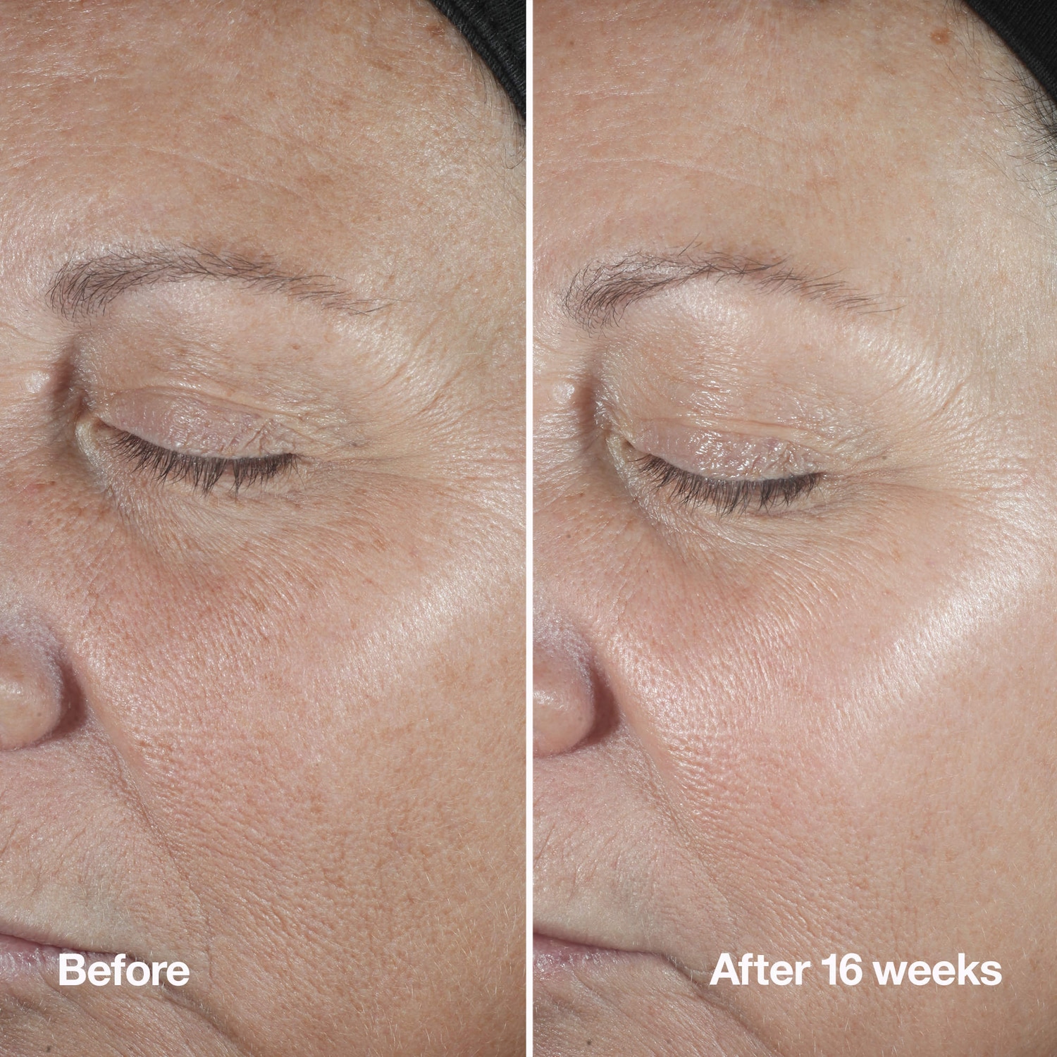 Smart Clinical Repair™ Wrinkle Correcting Anti-Aging Serum with 1% Retinoid