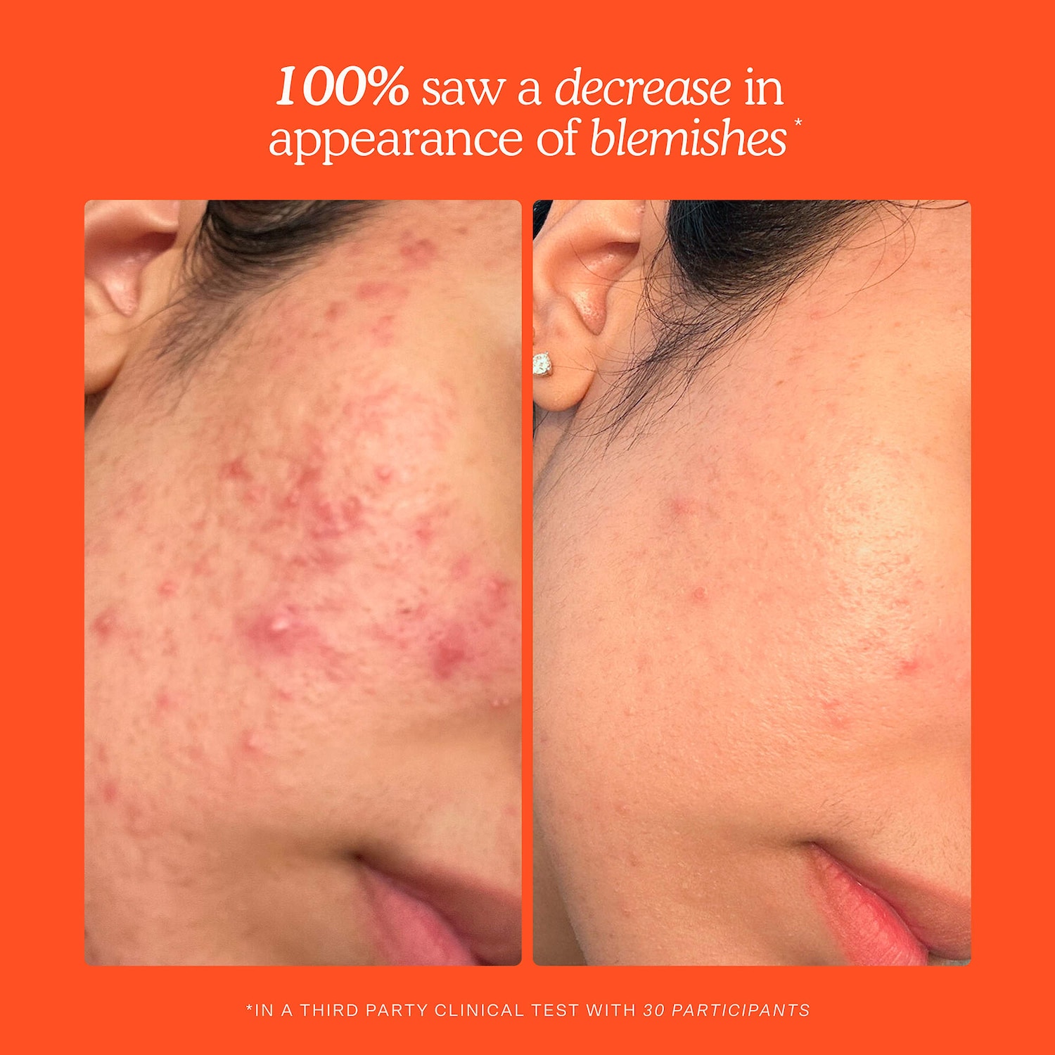 SOS Save.Our.Skin Daily Rescue Facial Spray - Tower 28 Beauty