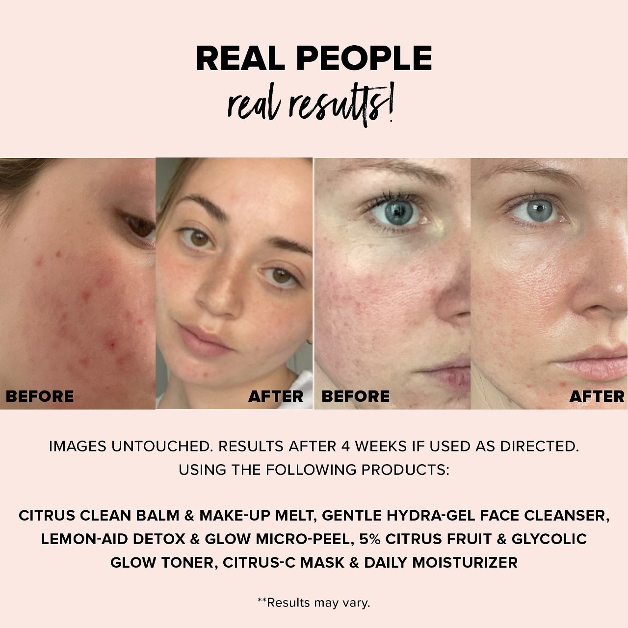 Очищающий бальзам для снятия макияжа Nudestix Nudeskin Citrus Clean Balm & Make-Up Melt — фото 4