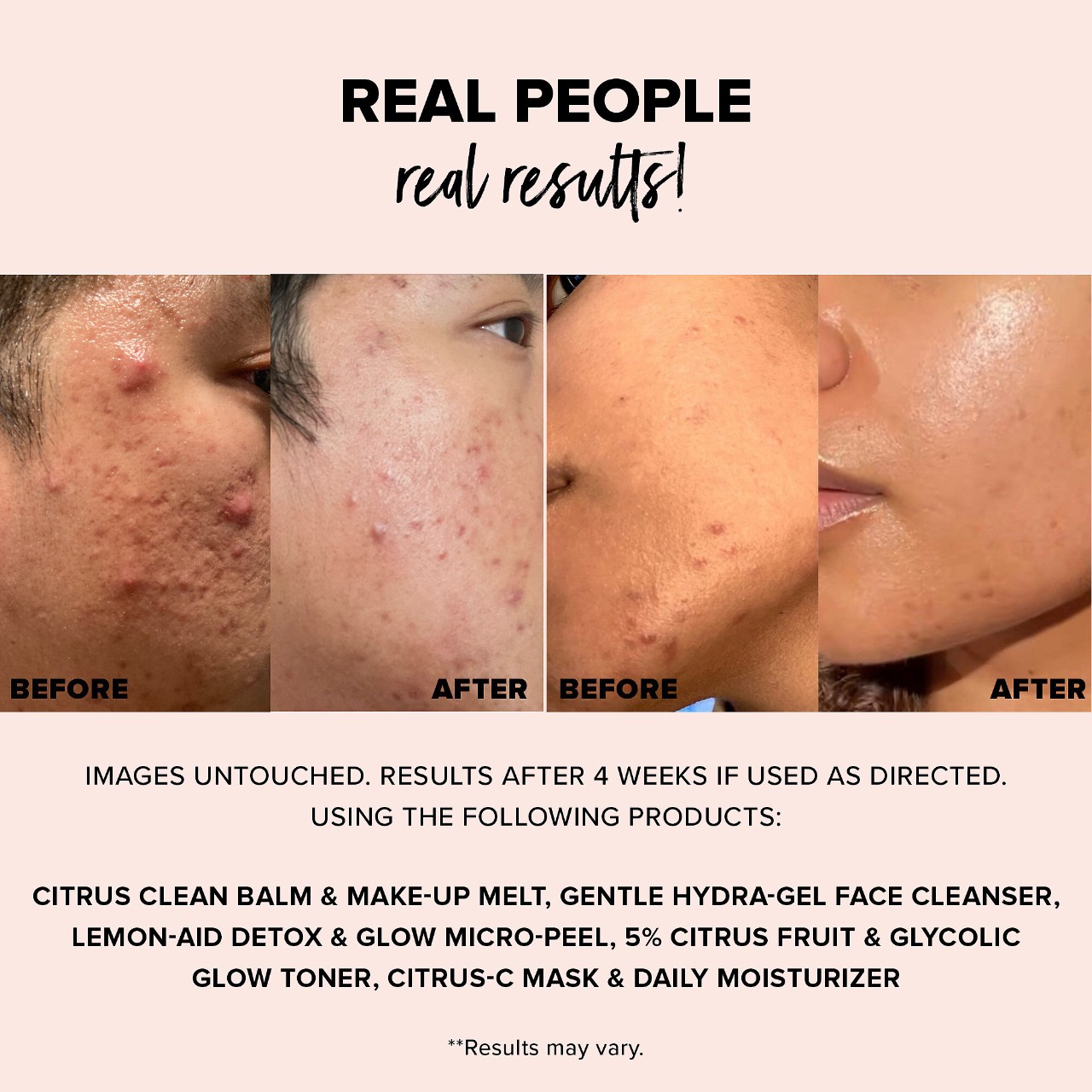 Очищающий бальзам для снятия макияжа Nudestix Nudeskin Citrus Clean Balm & Make-Up Melt — фото 7