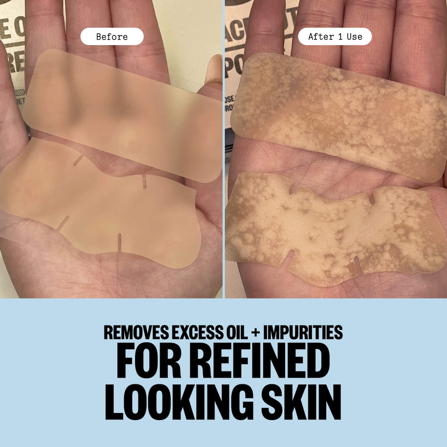 Oil-Absorbing Hydrocolloid Blackhead Remover Strips For Nose and Face