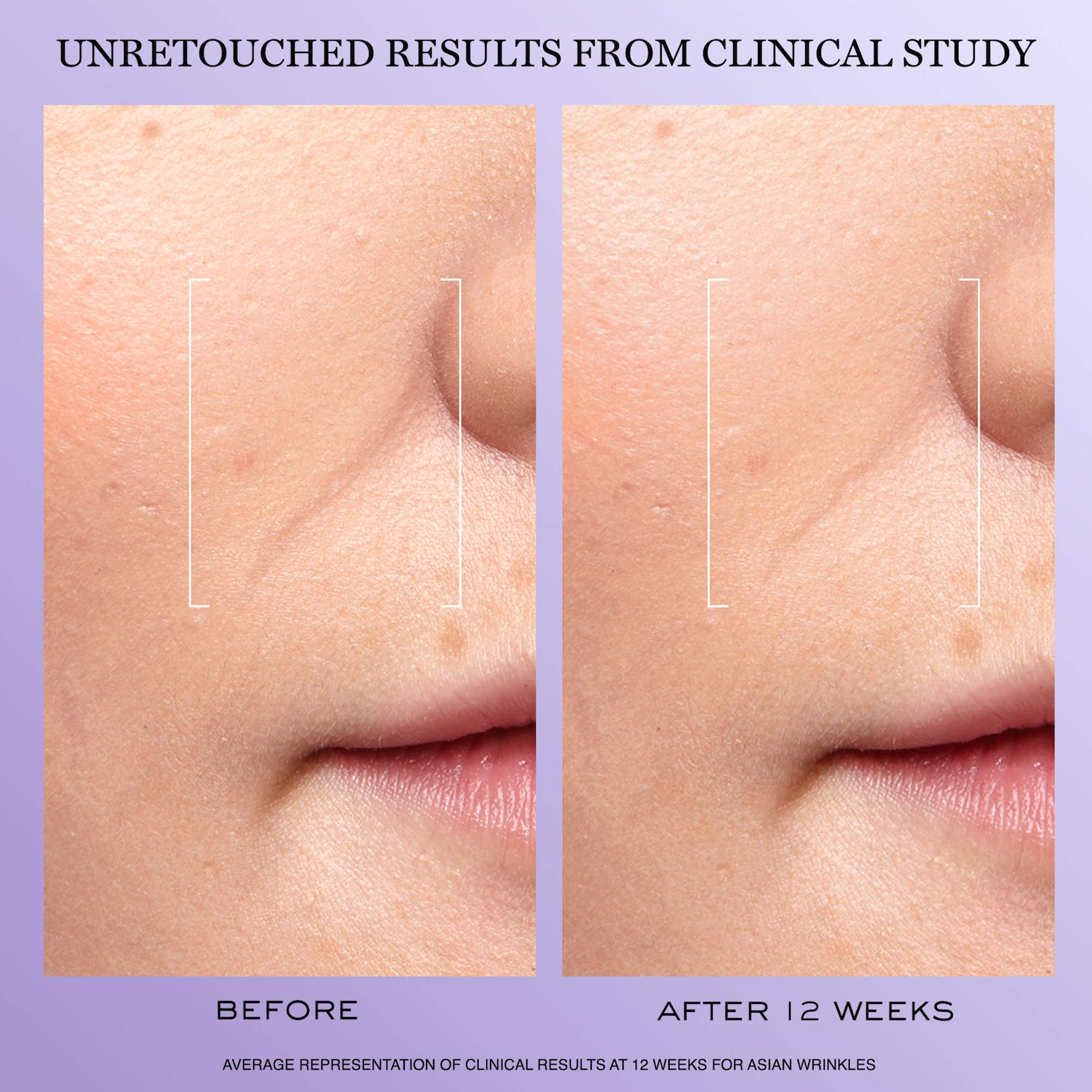 Rénergie H.C.F. Triple Serum: For Plumping & Anti-Aging