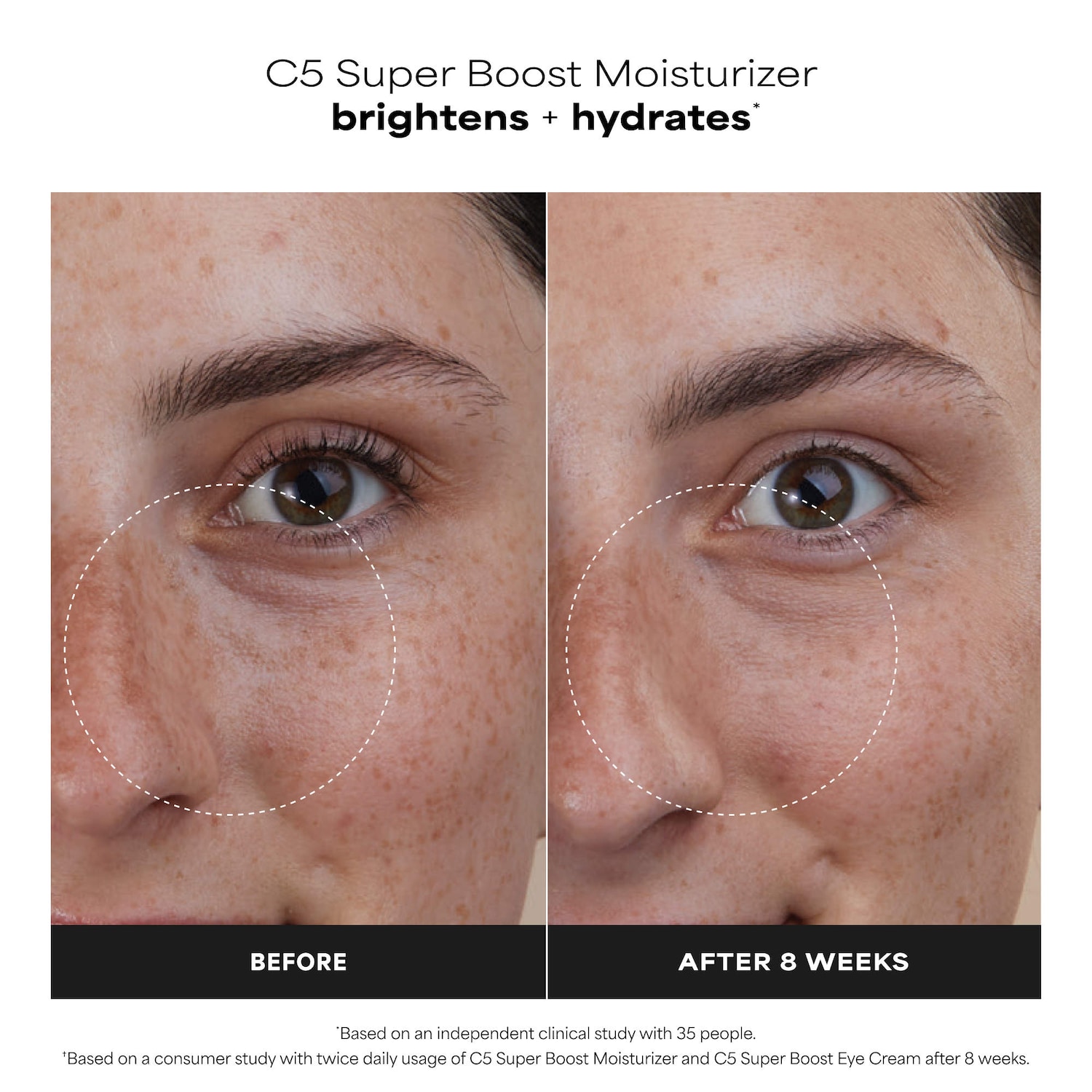 C5 Super Boost Vitamin C Moisturizer for Brightening and Evening Tone