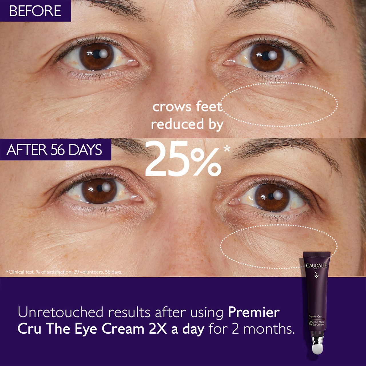 Premier Cru Anti-Aging Eye Cream for Fine Lines and Wrinkles