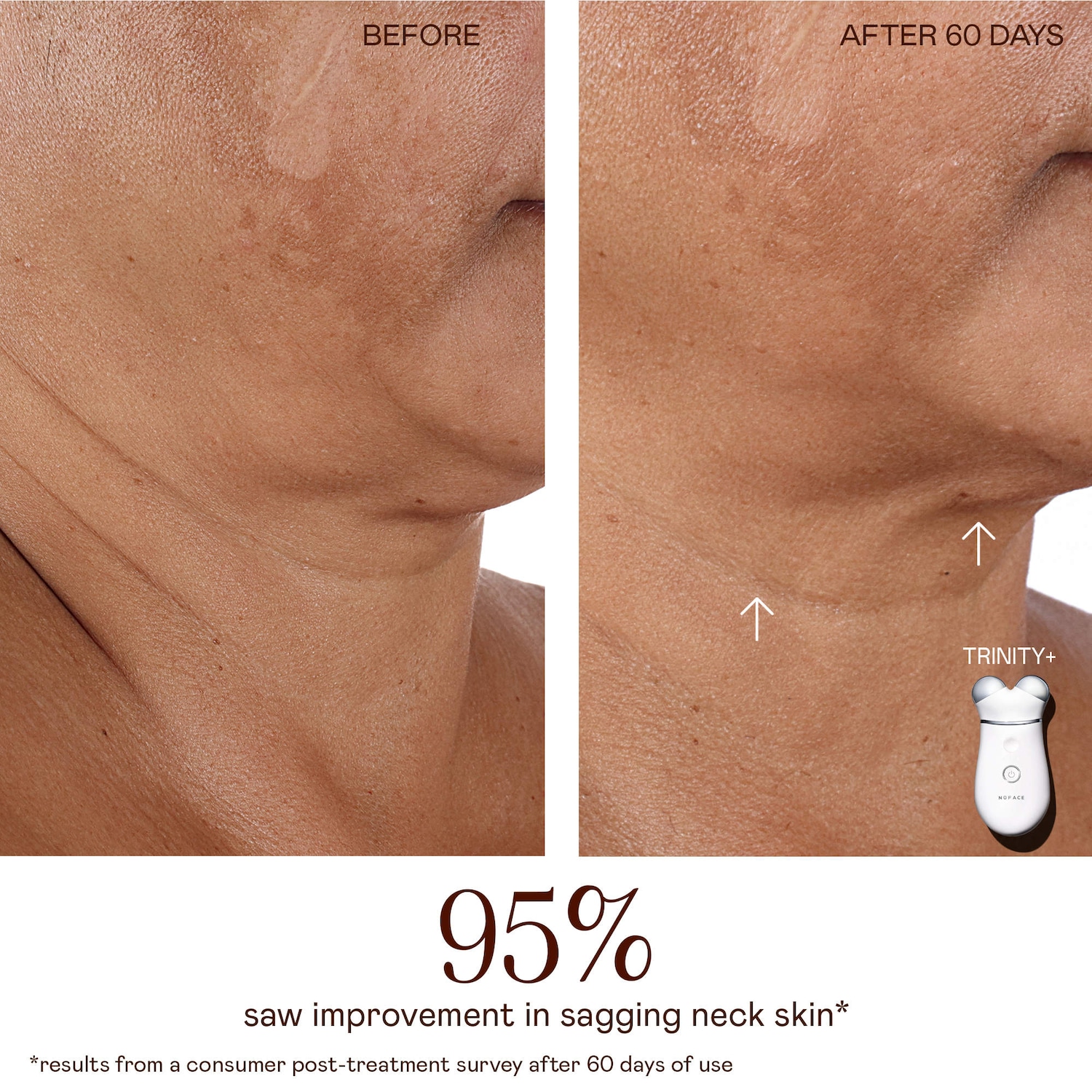 NUFACE® TRINITY+ Starter Kit Lift & Tighten Facial Microcurrent Device