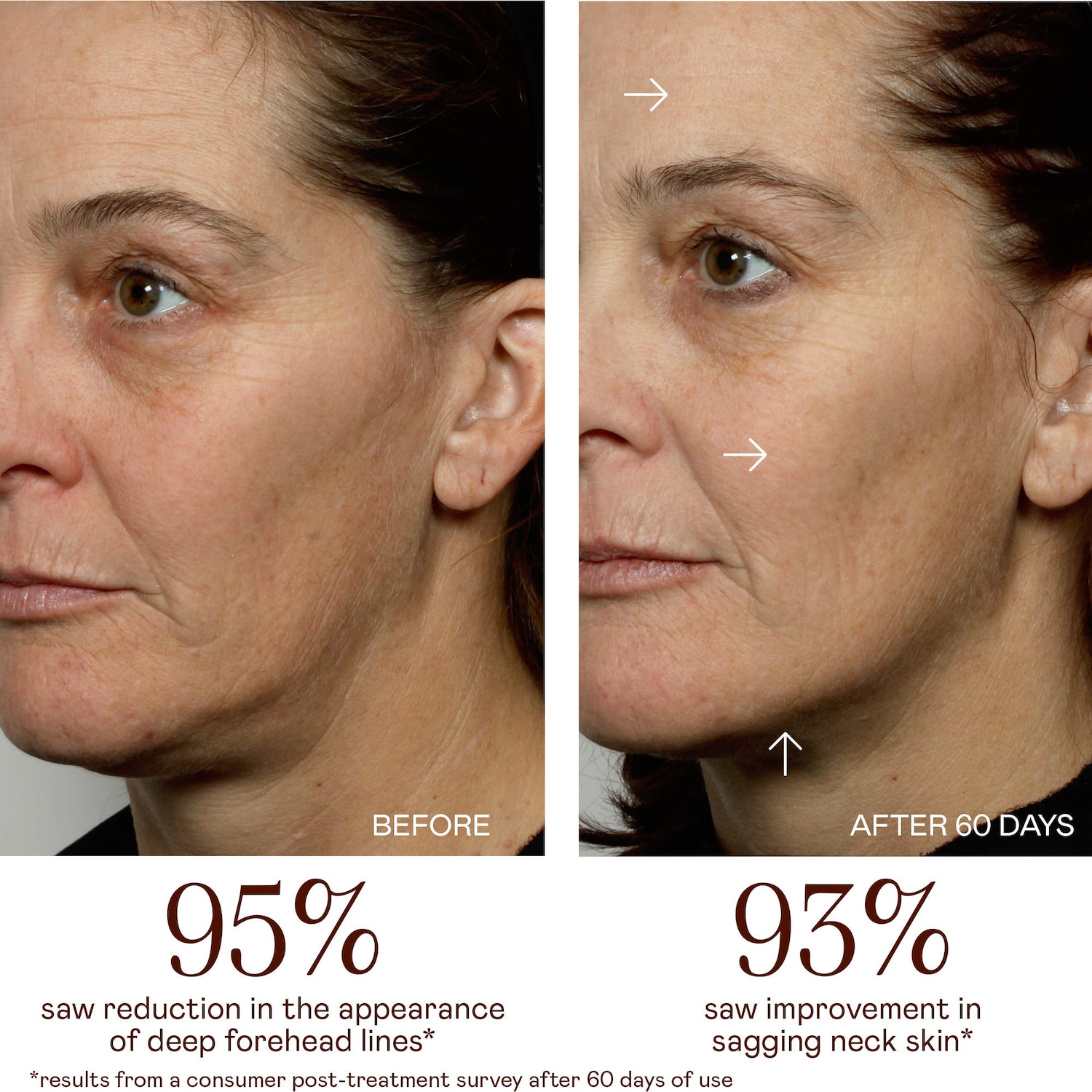 NUFACE® MINI+ Starter Kit | Sculpt & Tone Facial Microcurrent Device