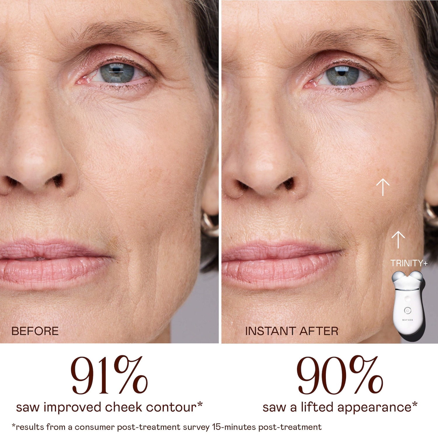 NUFACE® TRINITY+ Microcurrent + Targeted Toning Device Bundle