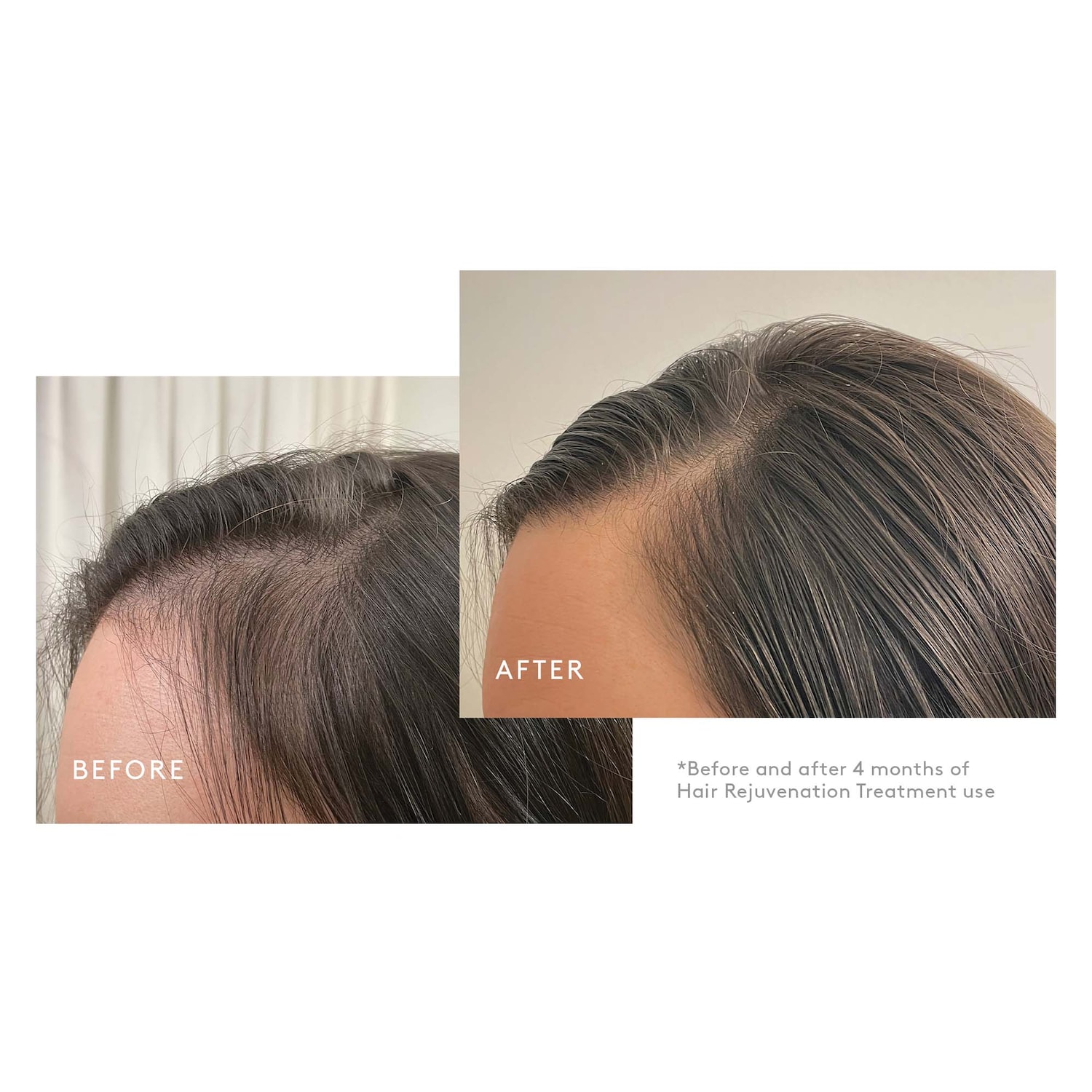 Virtue Flourish Hair Treatment - Thumbnail 3