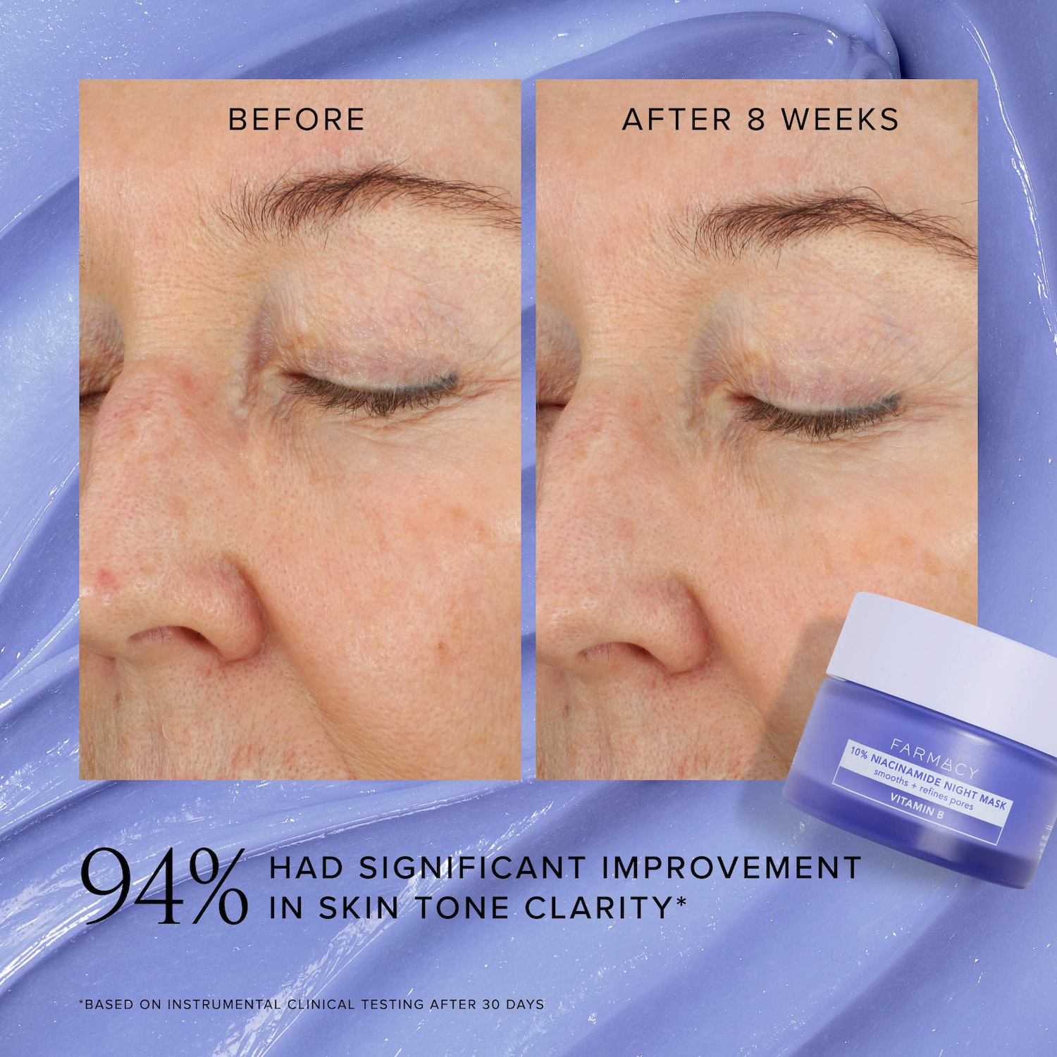 10% Niacinamide Night Mask