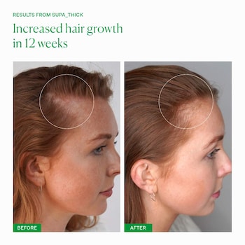 Supa Thick Scalp Serum with Rosemary