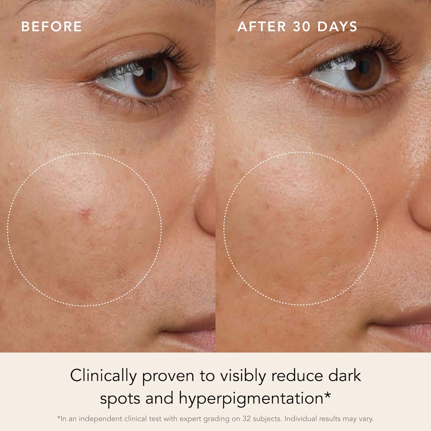 Brightening Dark Spot and Anti-Aging Facial Serum with Saffron Turmeric