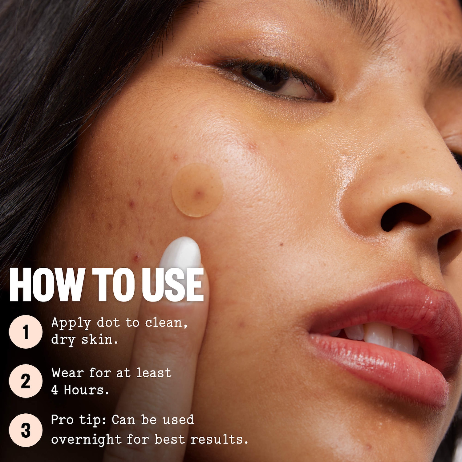Peace Out Salicylic Acid Acne Healing Dots Mega Value Pack + Free Travel Bag