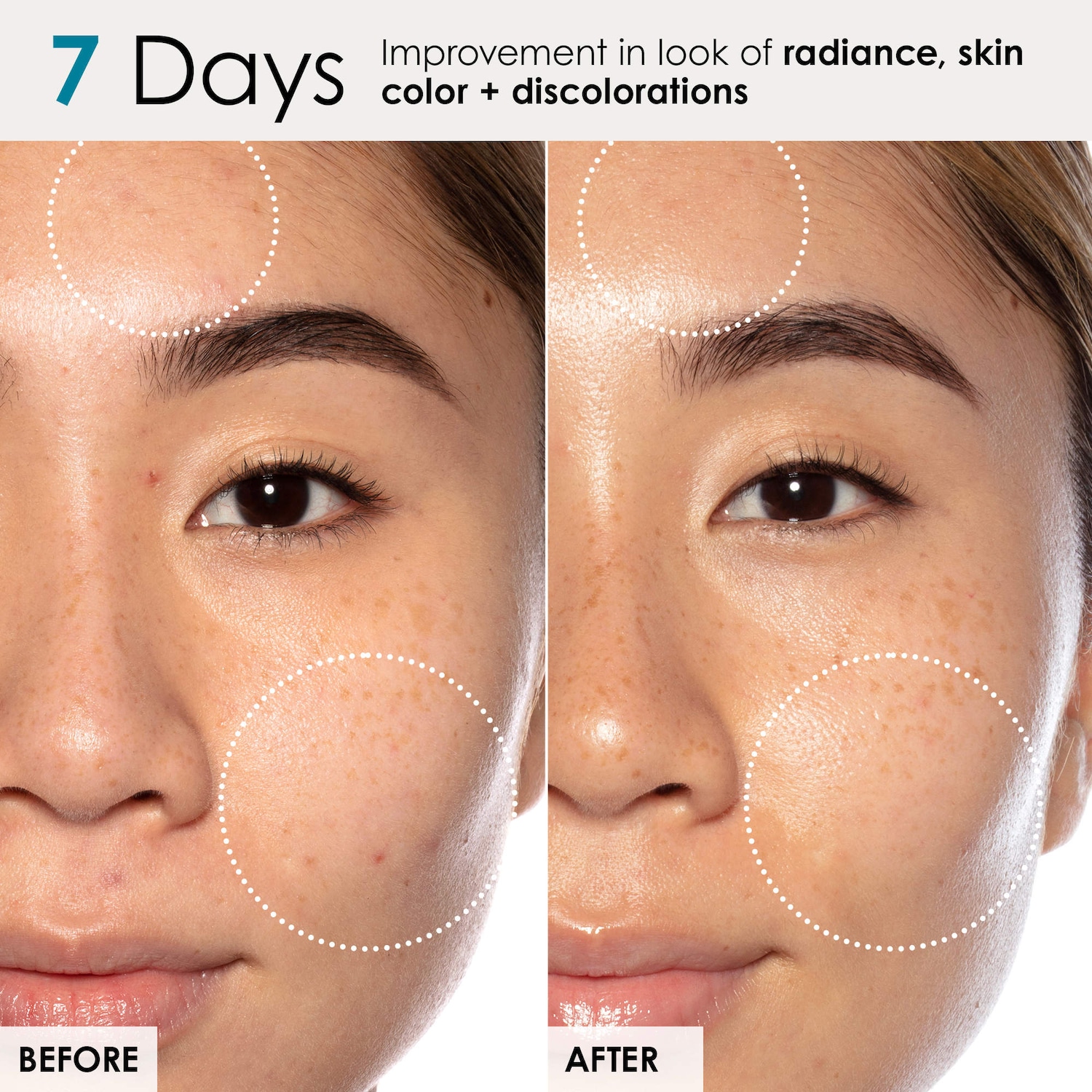 Good Genes All-In-One Lactic Acid Serum For Dark Spots And Uneven Texture