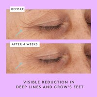 Ceramighty™  AF Eye Cream with Ceramides