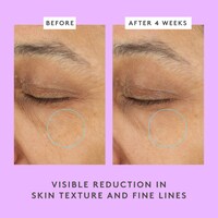 Ceramighty™  AF Eye Cream with Ceramides