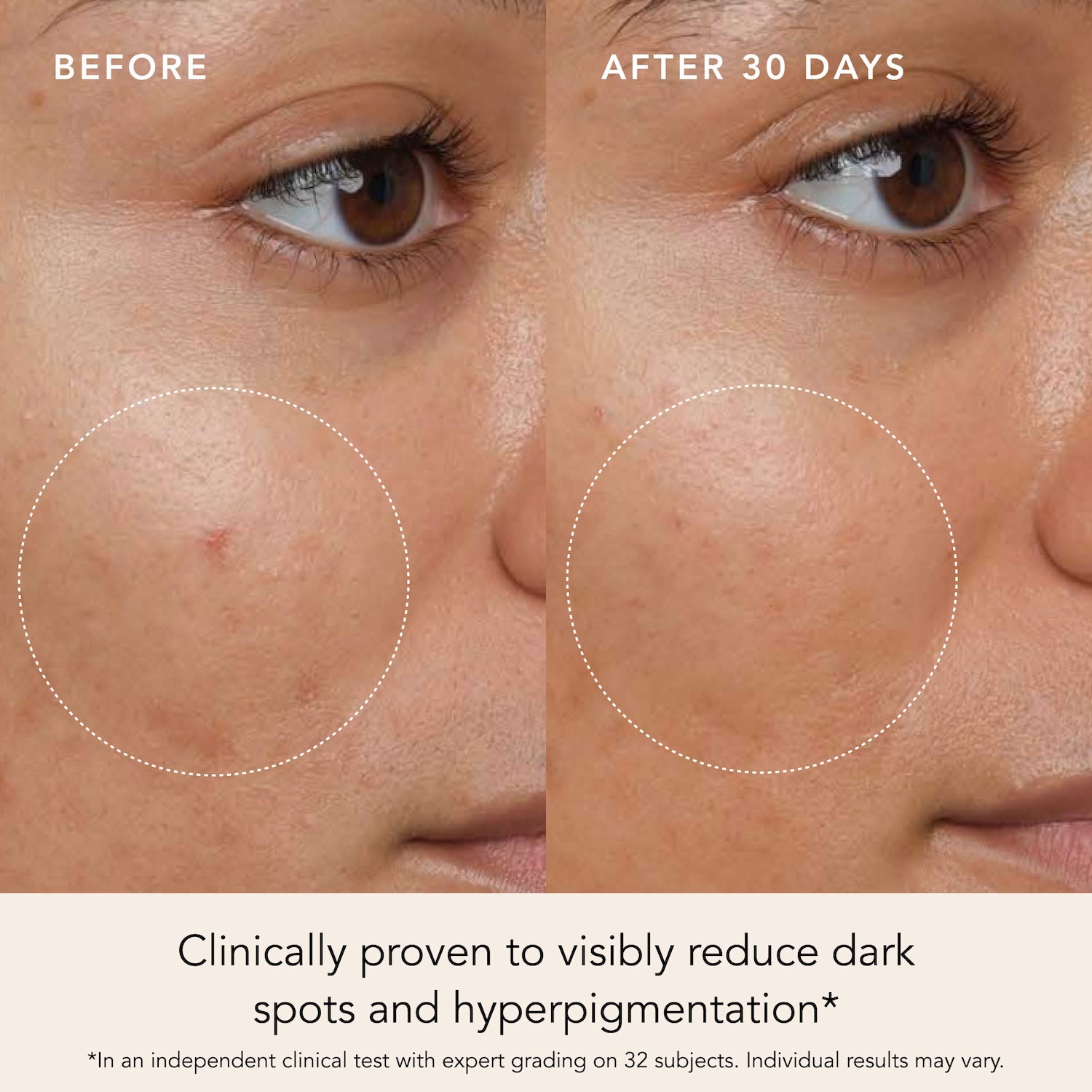 Brightening Dark Spot and Anti-Aging Facial Serum with Saffron Turmeric
