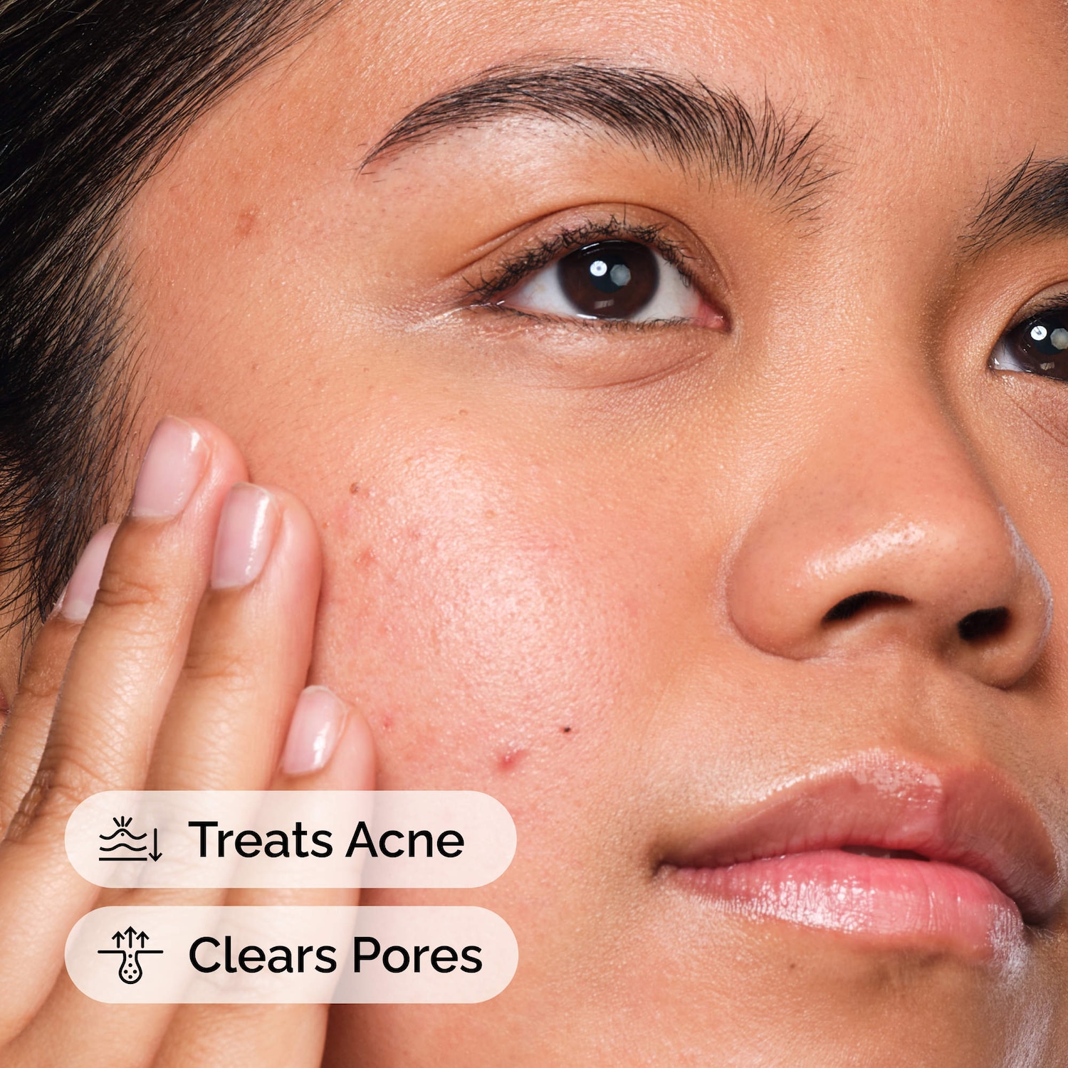Salicylic Acid 2% Solution, Exfoliating Serum for Acne