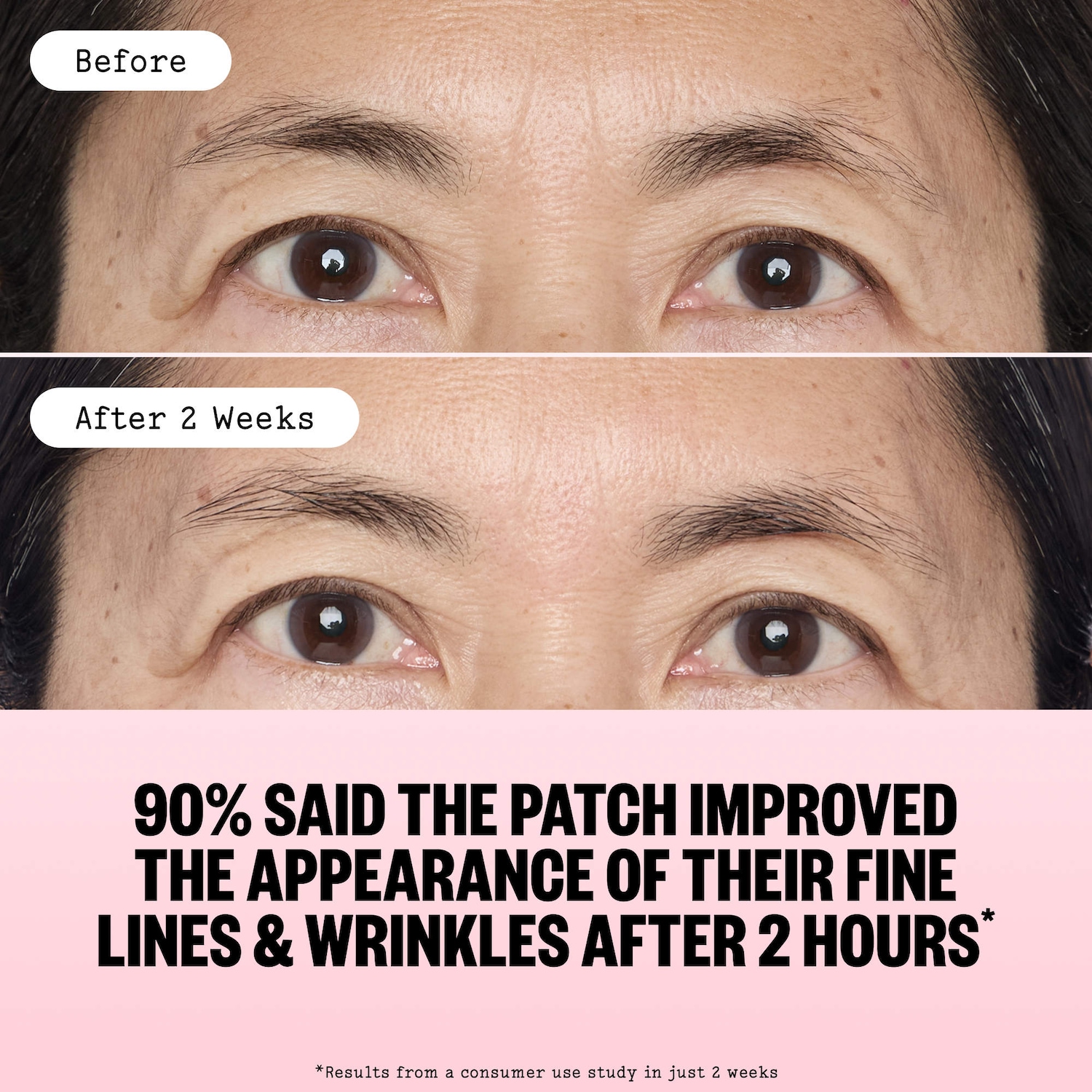 Microneedling Wrinkle Patches For Face with Retinol, Peptides, and Vitamin C