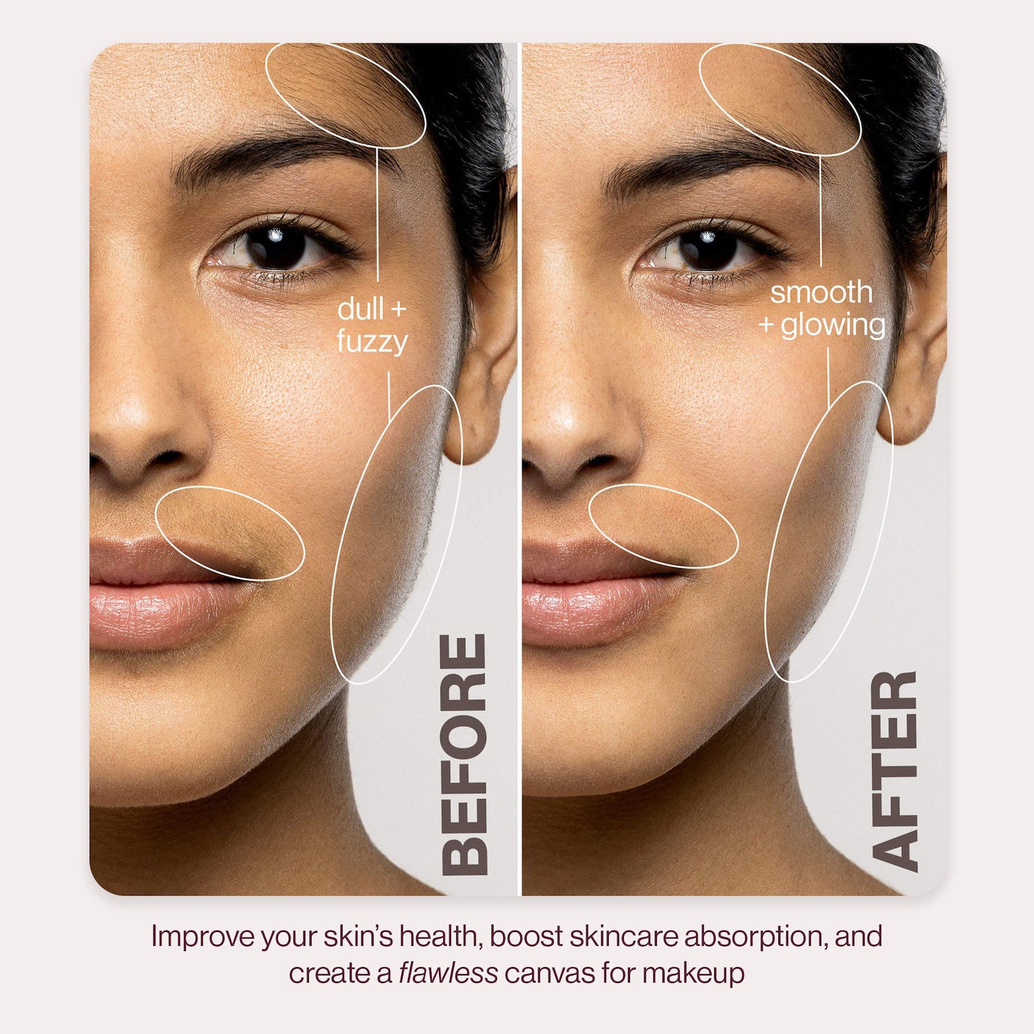 Аппарат для дермапланинга и удаления пушковых волосков Dermaflash LUXE+ Advanced Sonic, цвет: Пудровый розовый — фото 5