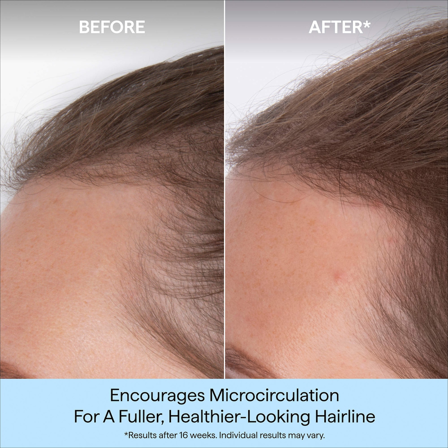 Destined for Density™ Peptide Hair Serum for Thicker, Fuller Hair