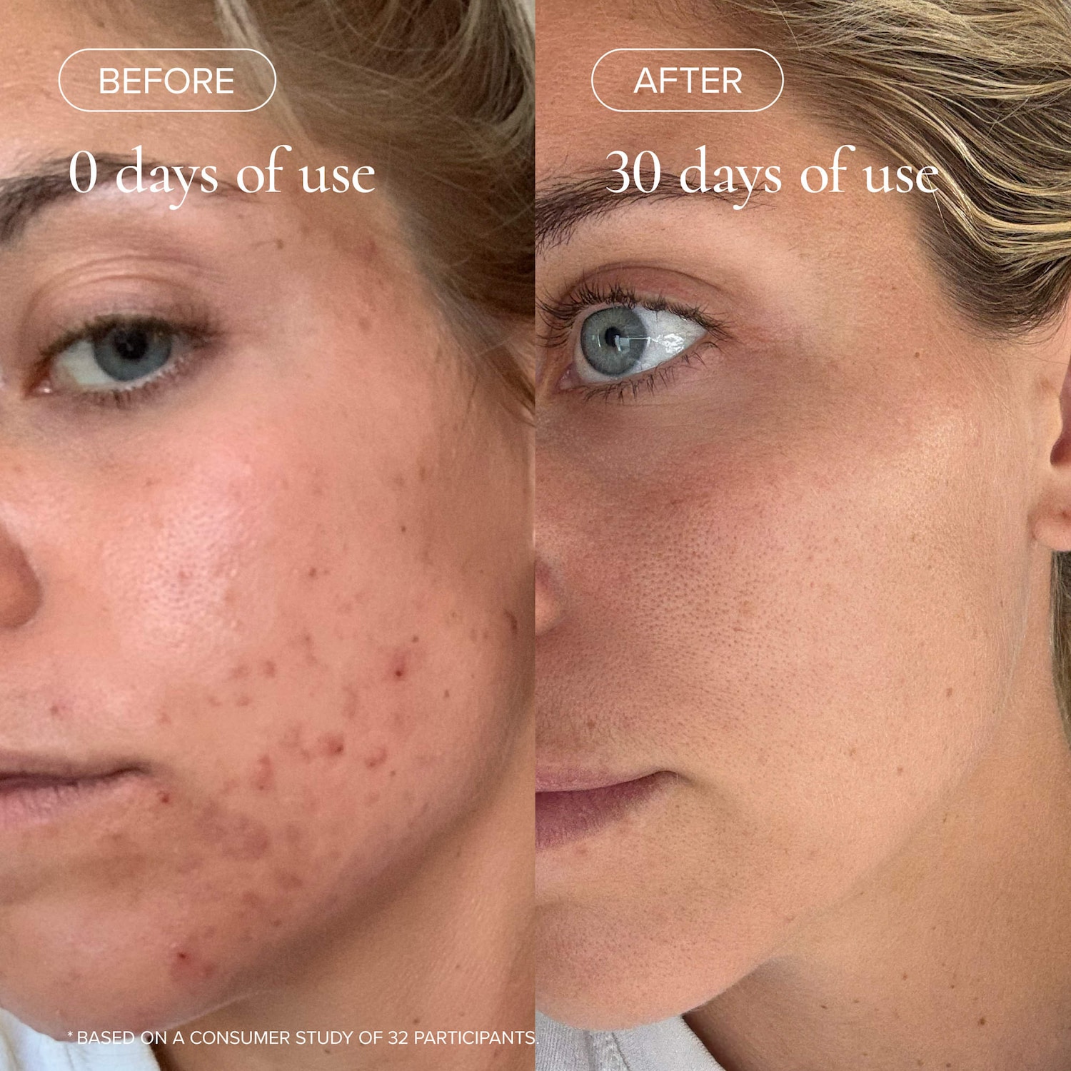 Flower Acid Algae Resurfacing Serum with 11% Lactic Acid + PHA