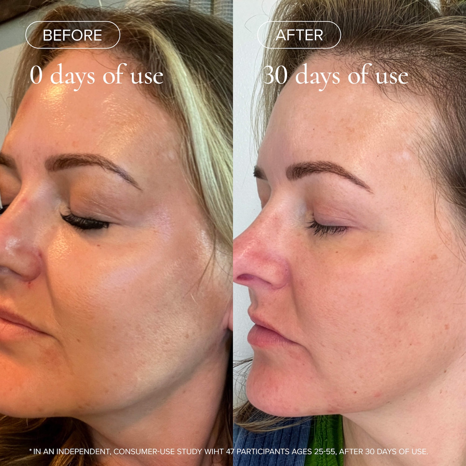 Sea Vitamin C Serum for Brightening Dark Spots & Redness with Algae