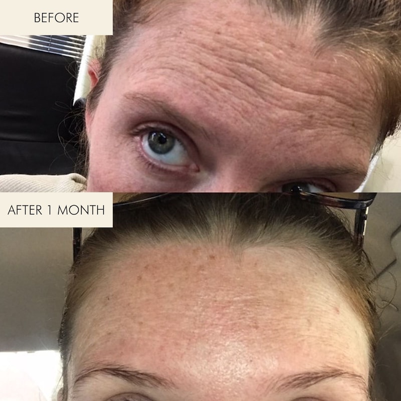 Mini 1.2% Clean Algae Retinol Face Oil for Anti-Aging and Wrinkles with Green Tea thumbnail 4