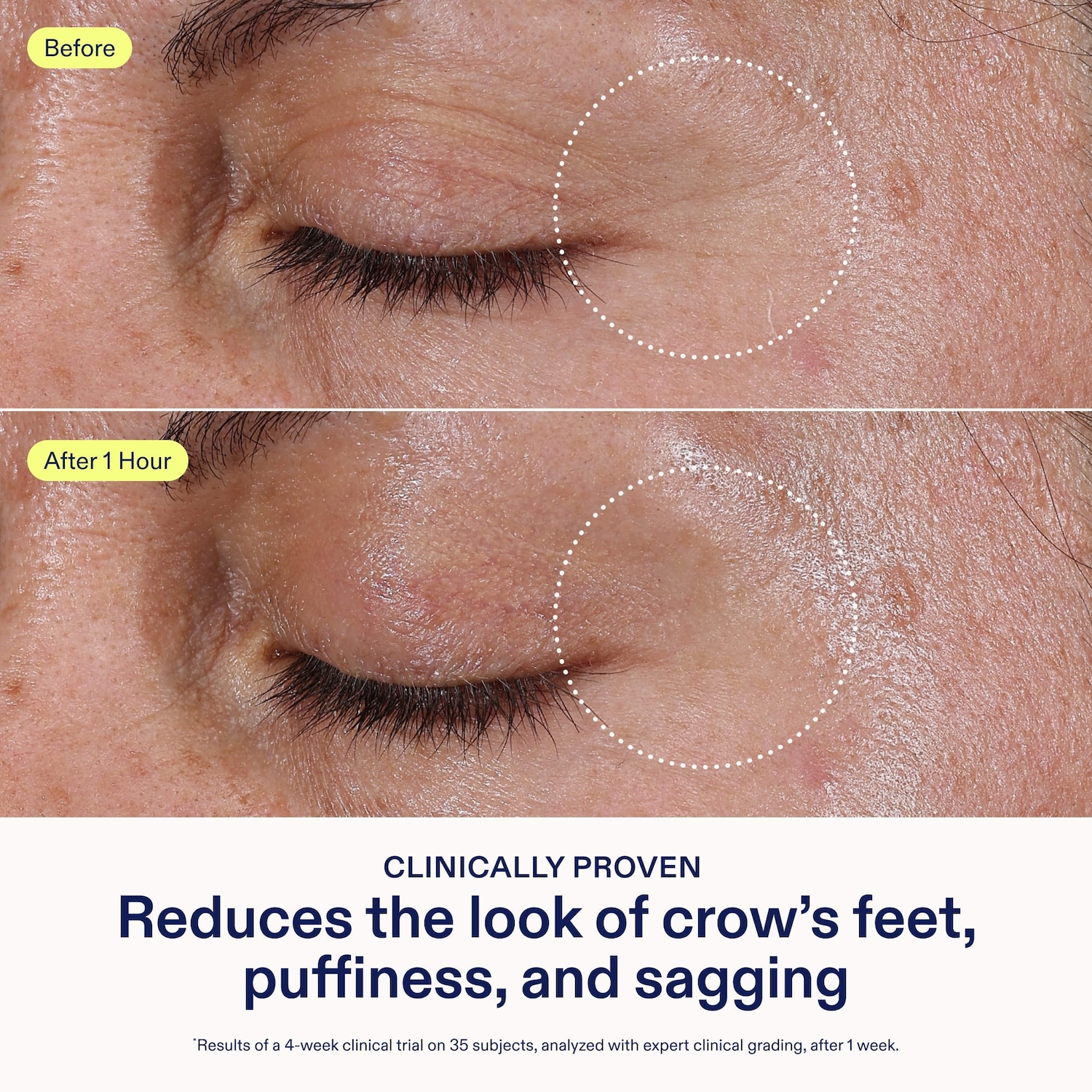 Crème contour des yeux illuminante Triple Lipid barrier+