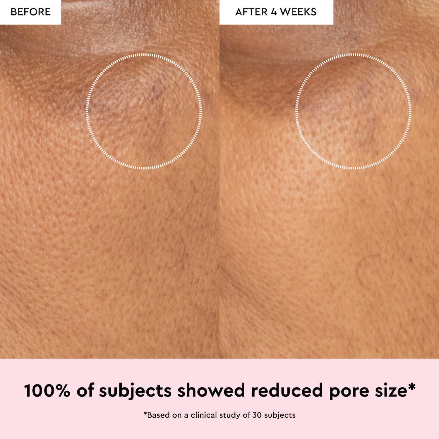Watermelon Glow Niacinamide Dew Drops Multipurpose Brightening Serum
