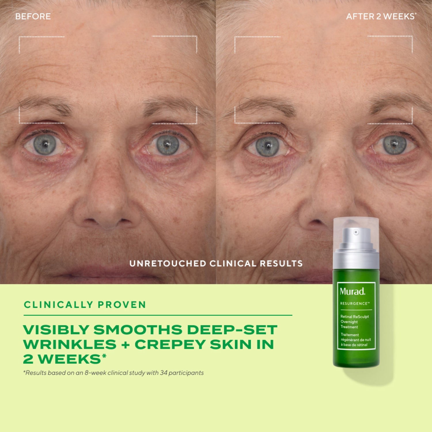 Ночная антивозрастная сыворотка для лифтинга Murad Retinal ReSculpt — фото 4