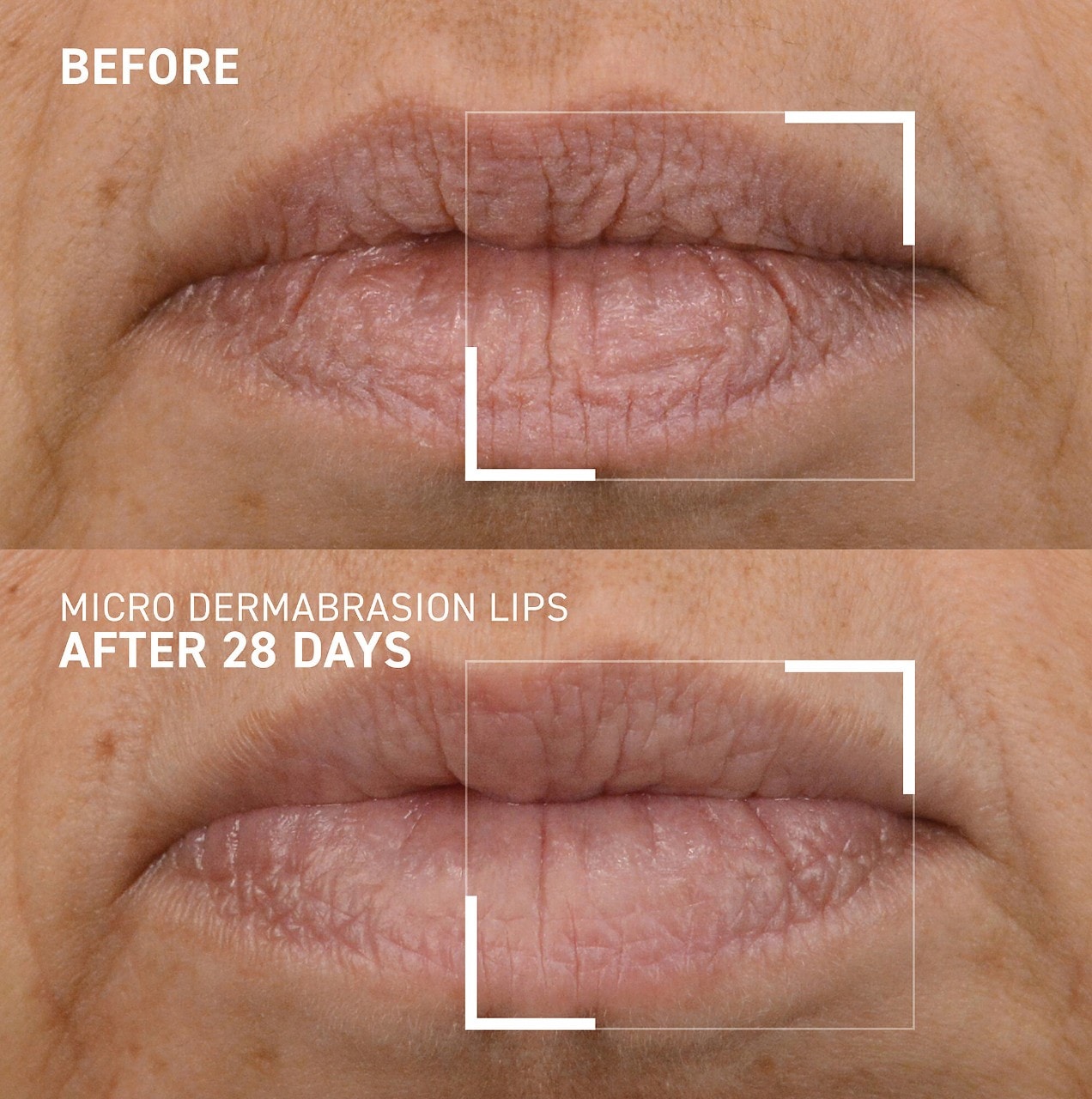 Dr. Brandt Skincare Microdermabrasion Smoothing Lip Scrub Hamilton Place