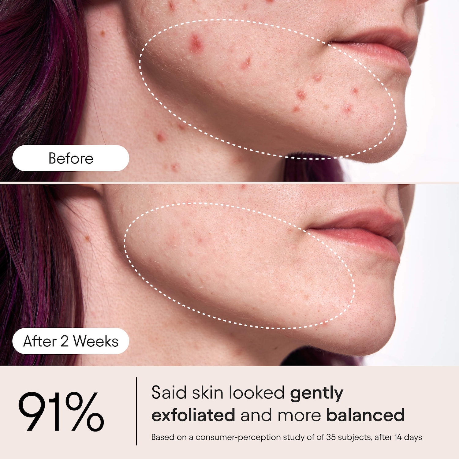 2% BHA Pore Perfecting Liquid Exfoliator for Brighter & Clearer Skin