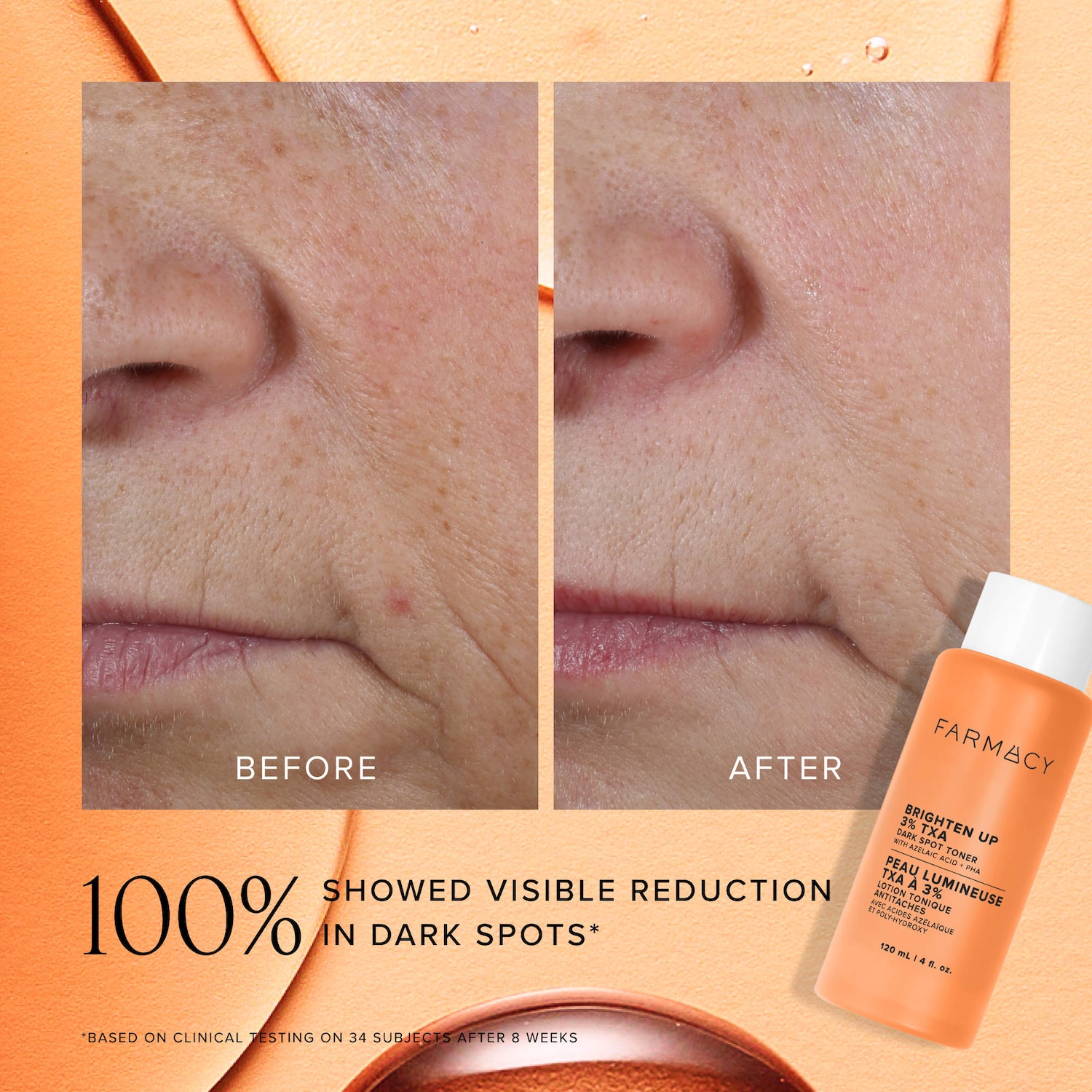 Brighten Up 3% TXA Dark Spot Toner with Azelaic Acid