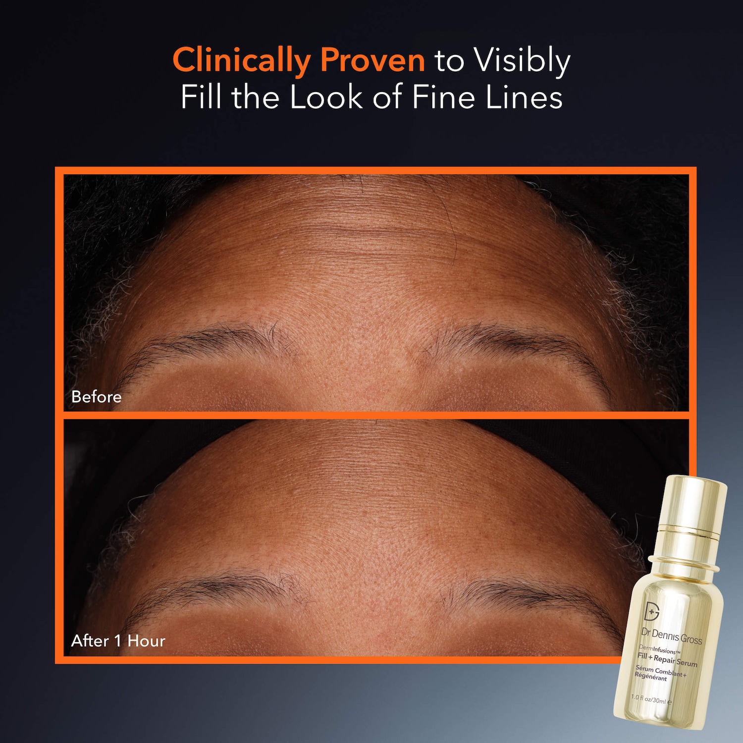 DermInfusions™ Fill + Repair Serum with Hyaluronic Acid