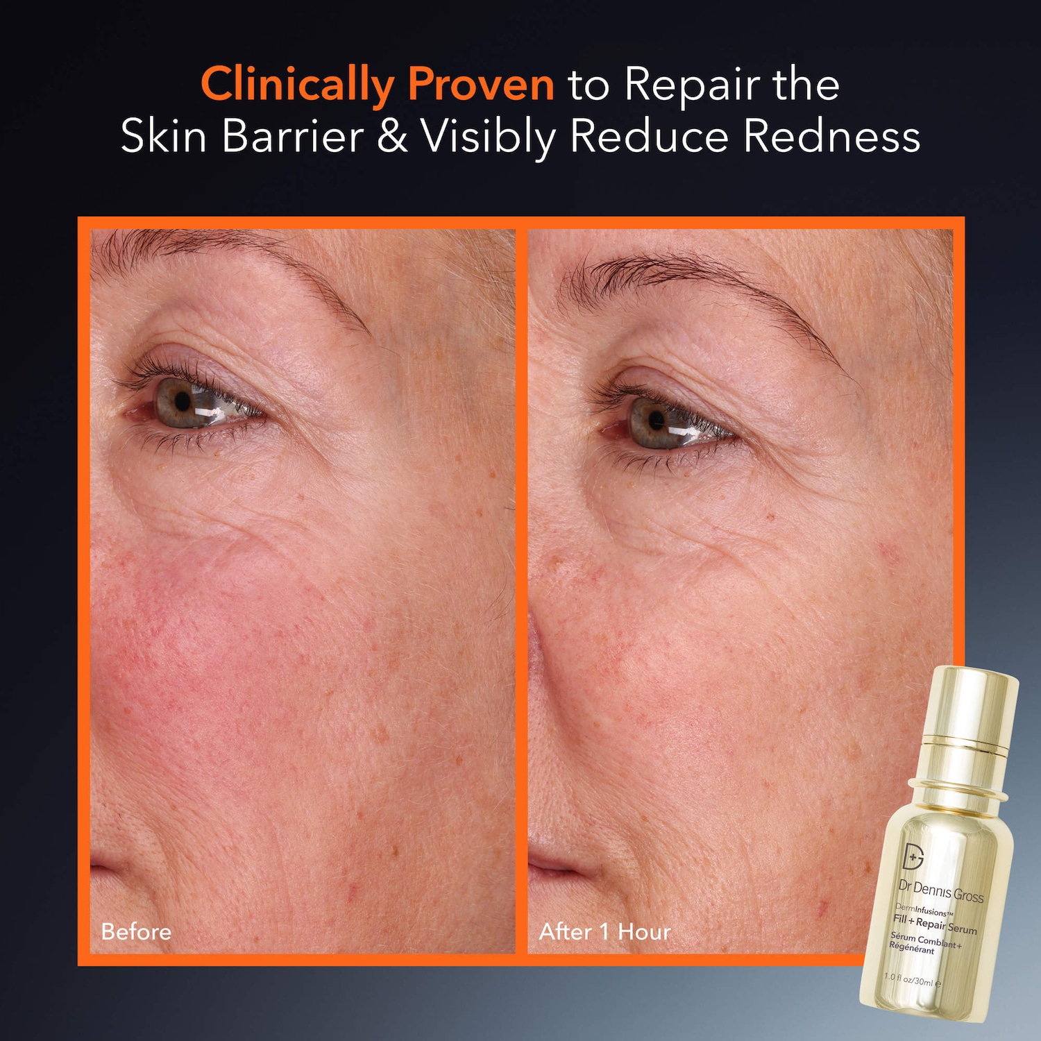 DermInfusions™ Fill + Repair Serum with Hyaluronic Acid