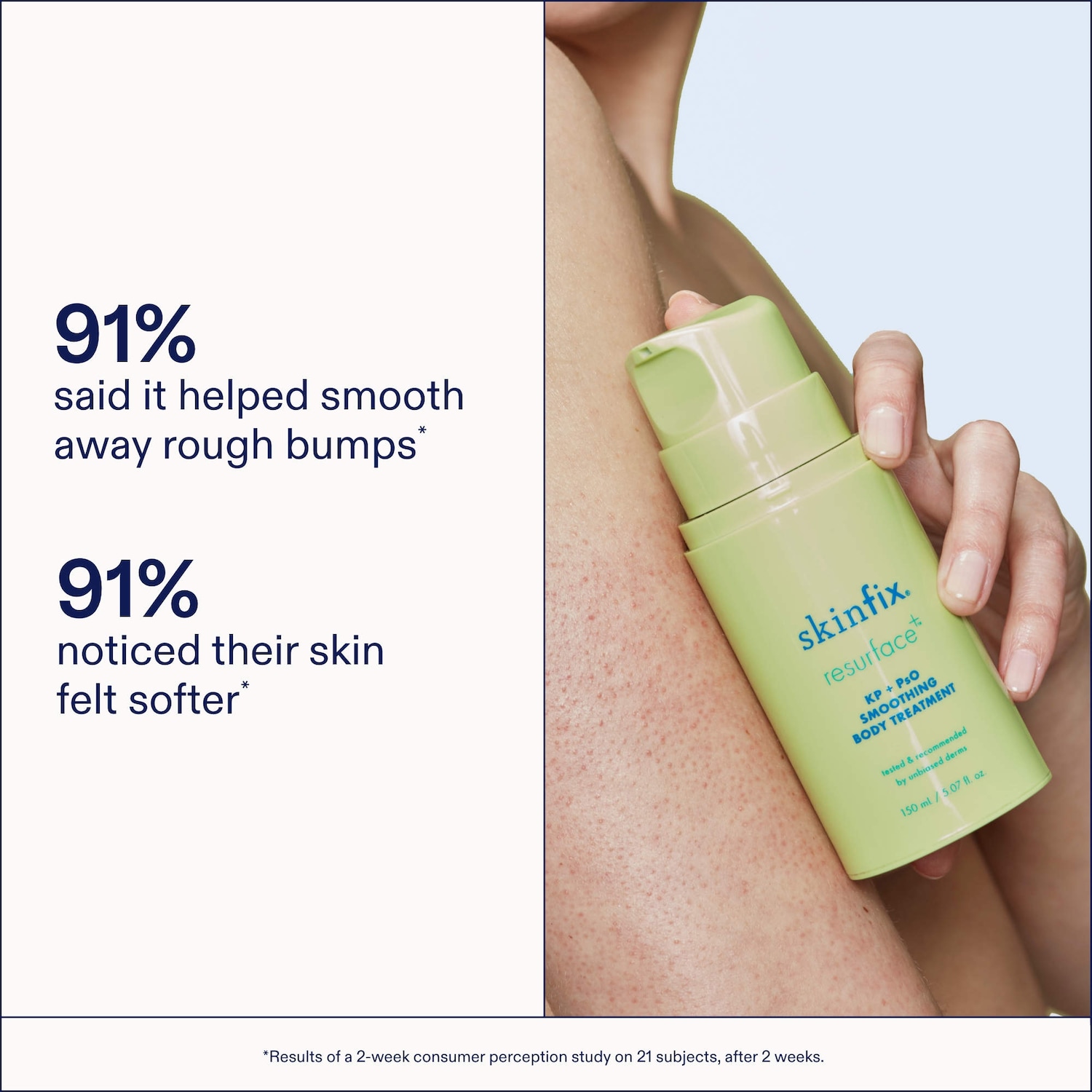KP+ Psoriasis Smoothing Treatment Body Lotion - Skinfix | Sephora