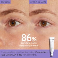 Vinoperfect Dark Circle Brightening Eye Cream with Niacinamide
