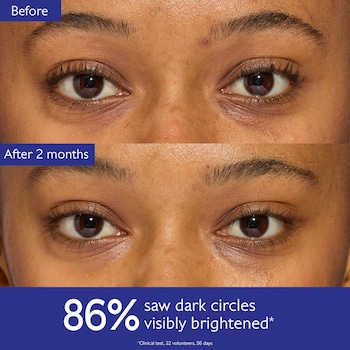 Vinoperfect Dark Circle Brightening Eye Cream with Niacinamide