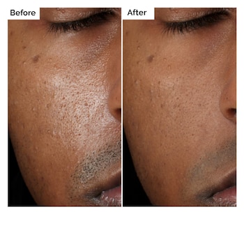 The Ordinary Aloe 2% + NAG 2% Solution 30 ml