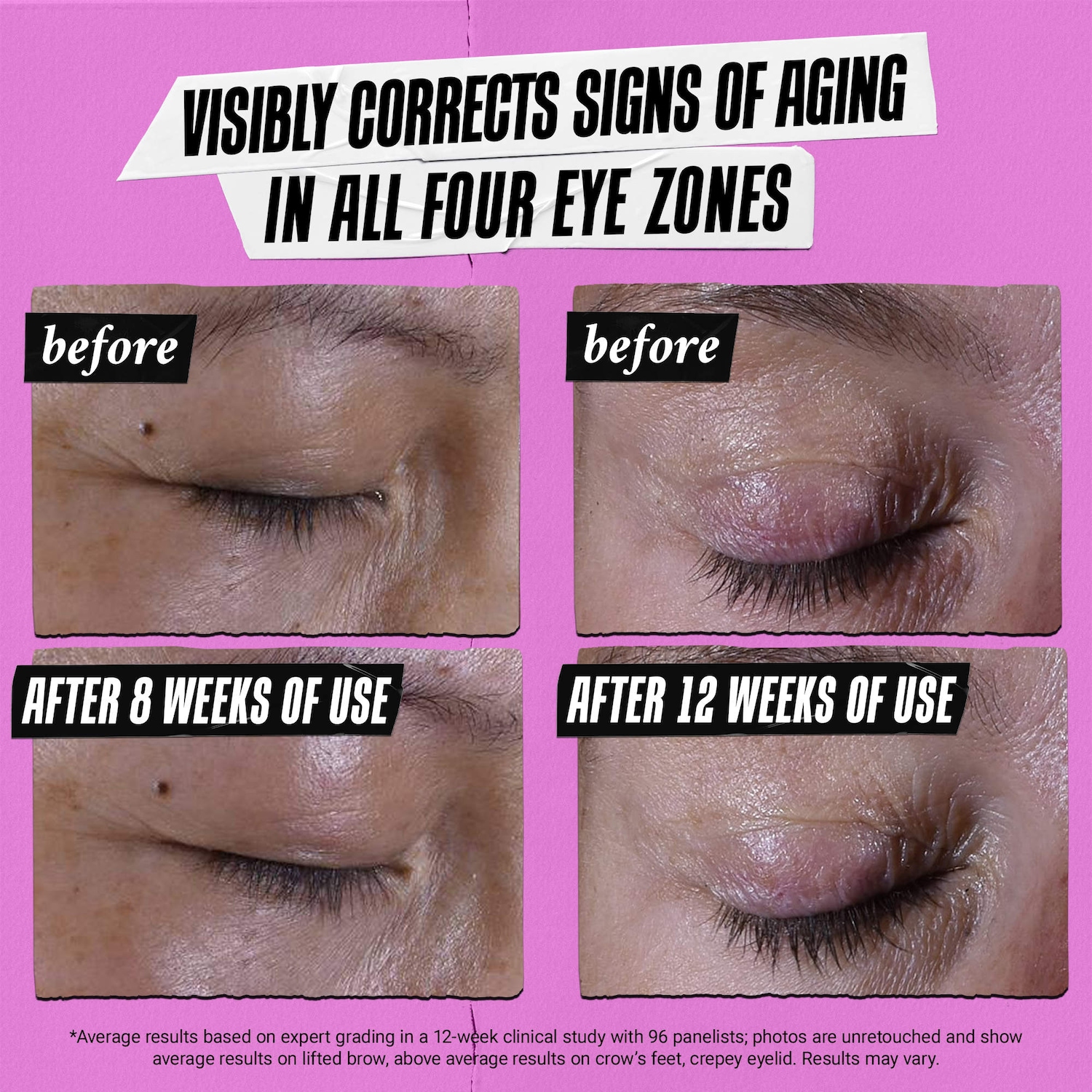 Super Multi-Corrective Anti-Aging Eye Cream with Collagen Peptide