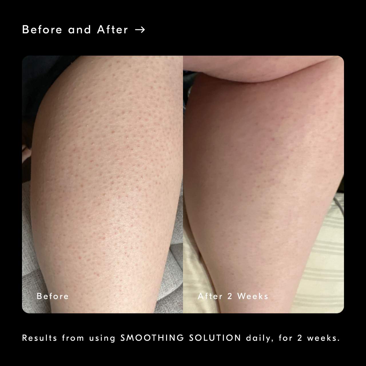 Химический пилинг-эксфолиант для тела с AHA Soft Services Smoothing Solution — фото 4