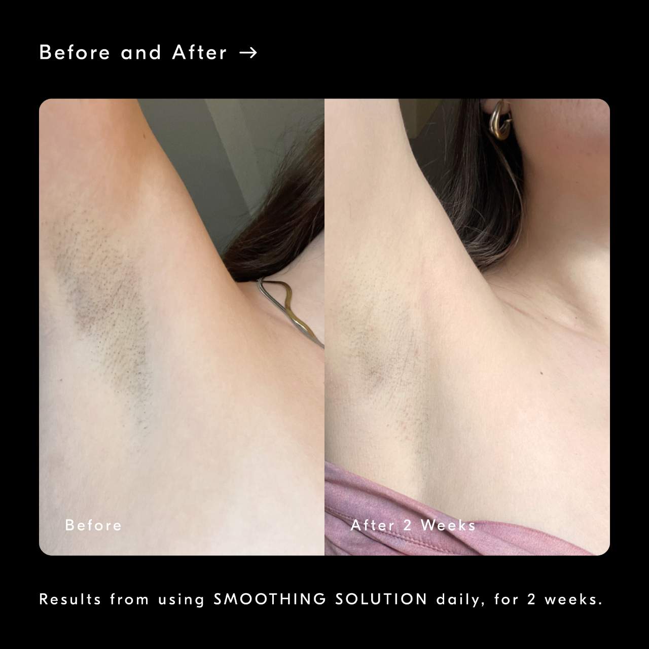 Химический пилинг-эксфолиант для тела с AHA Soft Services Smoothing Solution — фото 5