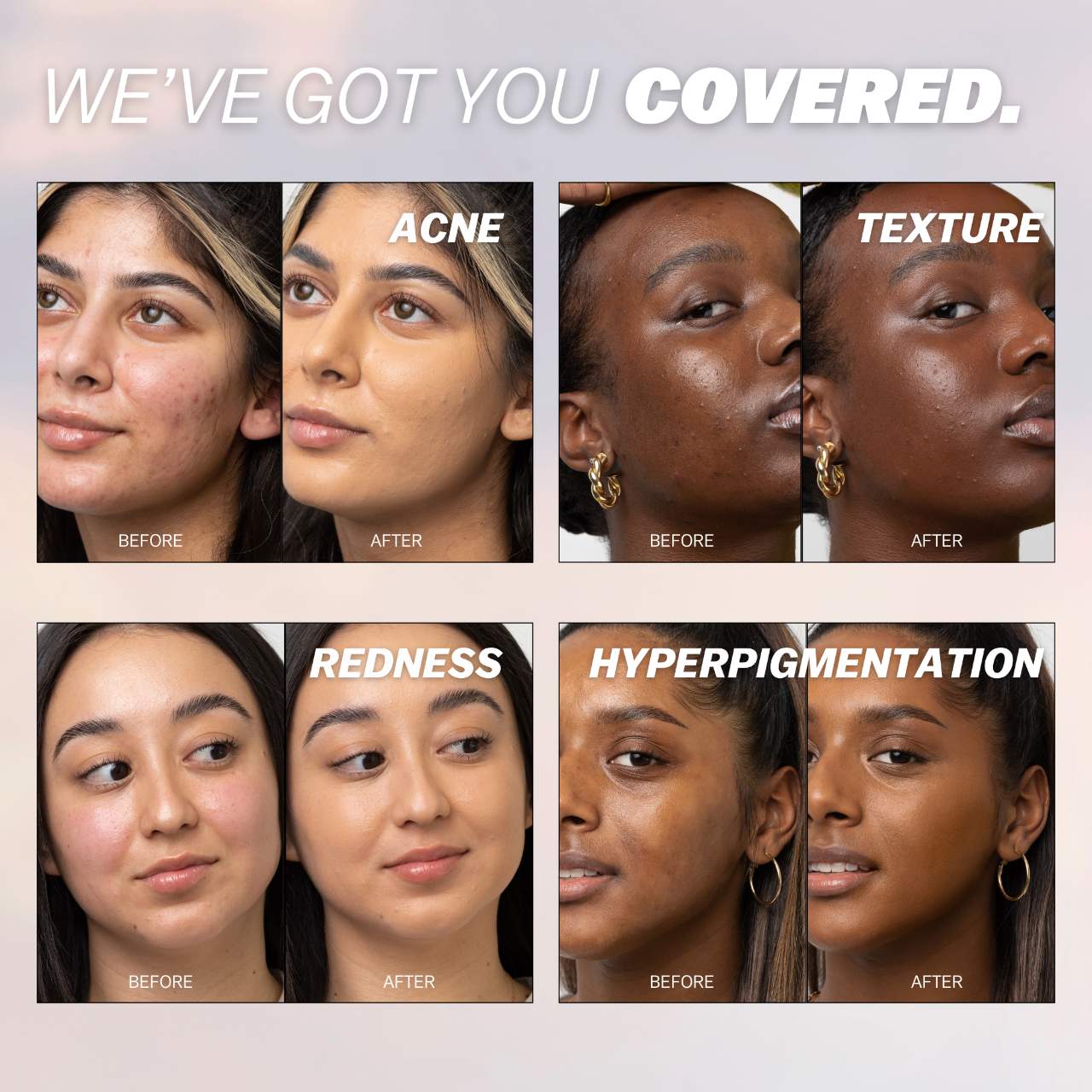 The Foundation Stick for Hydrating, Buildable Coverage and Natural Finish