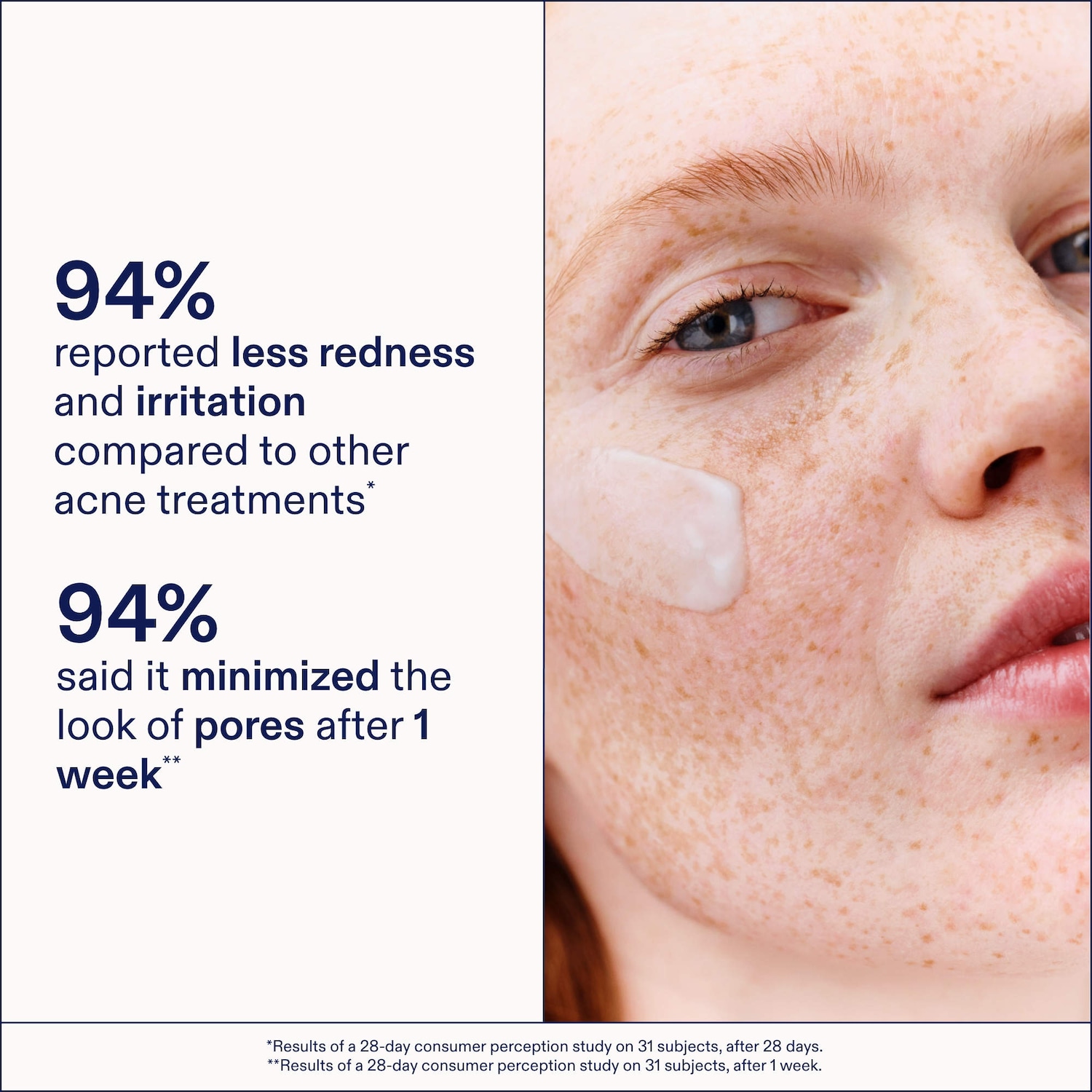 Gel à l’adapinoïde avec niacinamide et squalane acne+