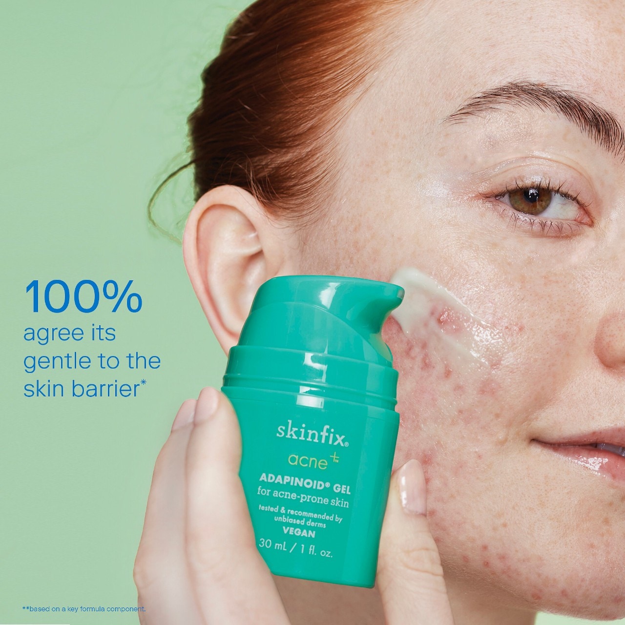 Гель с ниацинамидом и скваланом против акне Skinfix acne+ adapinoid — фото 5