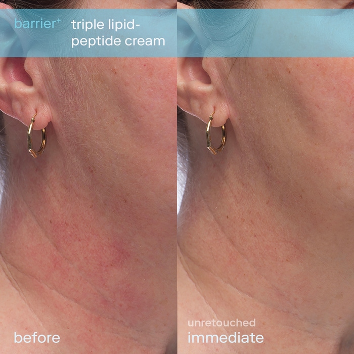 Набор для обезвоженной кожи Skinfix Better Skin Starts Here — фото 5